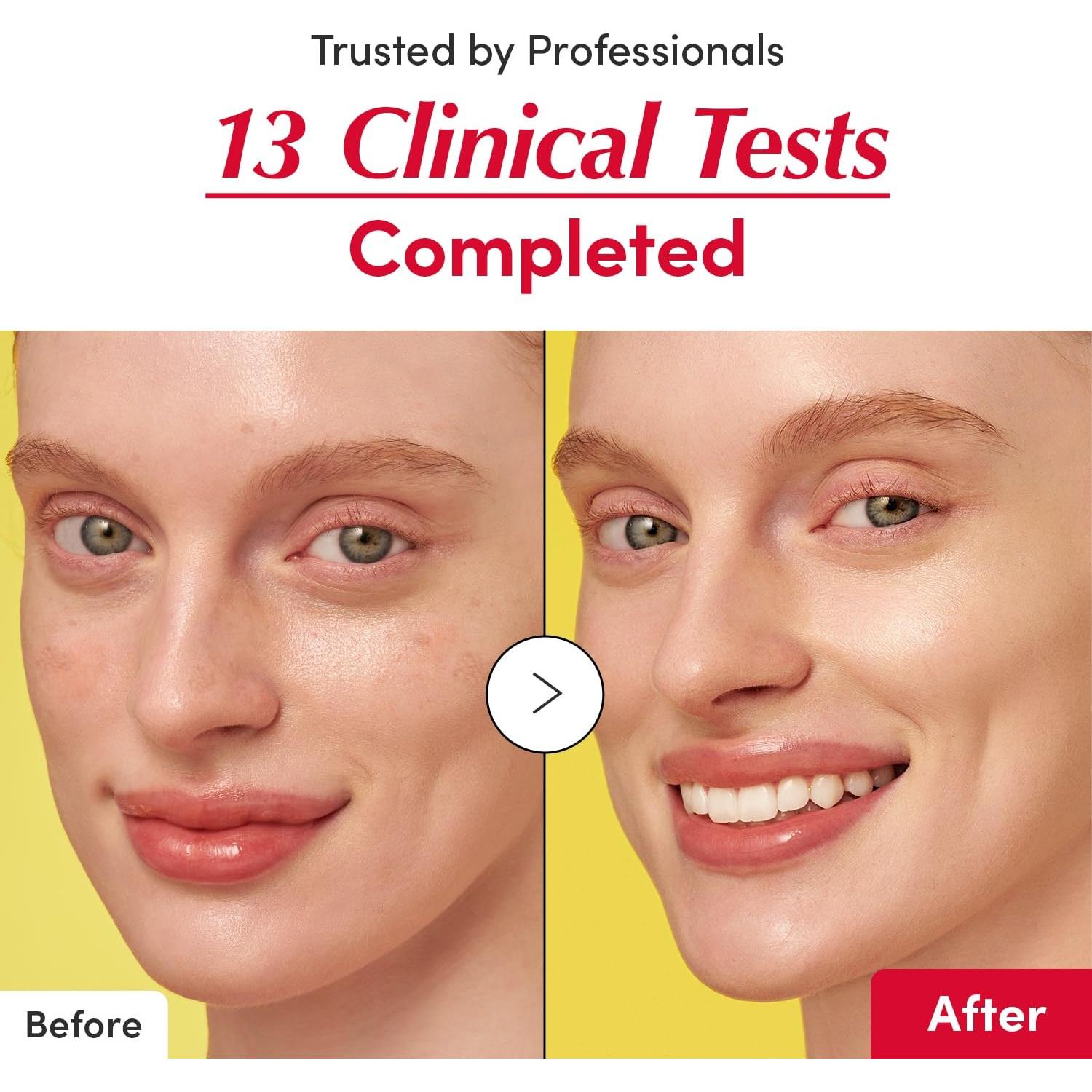 Suero Iluminador de Vitaminas VITAQUEEN 30ml - Vitamina C y Niacinamida