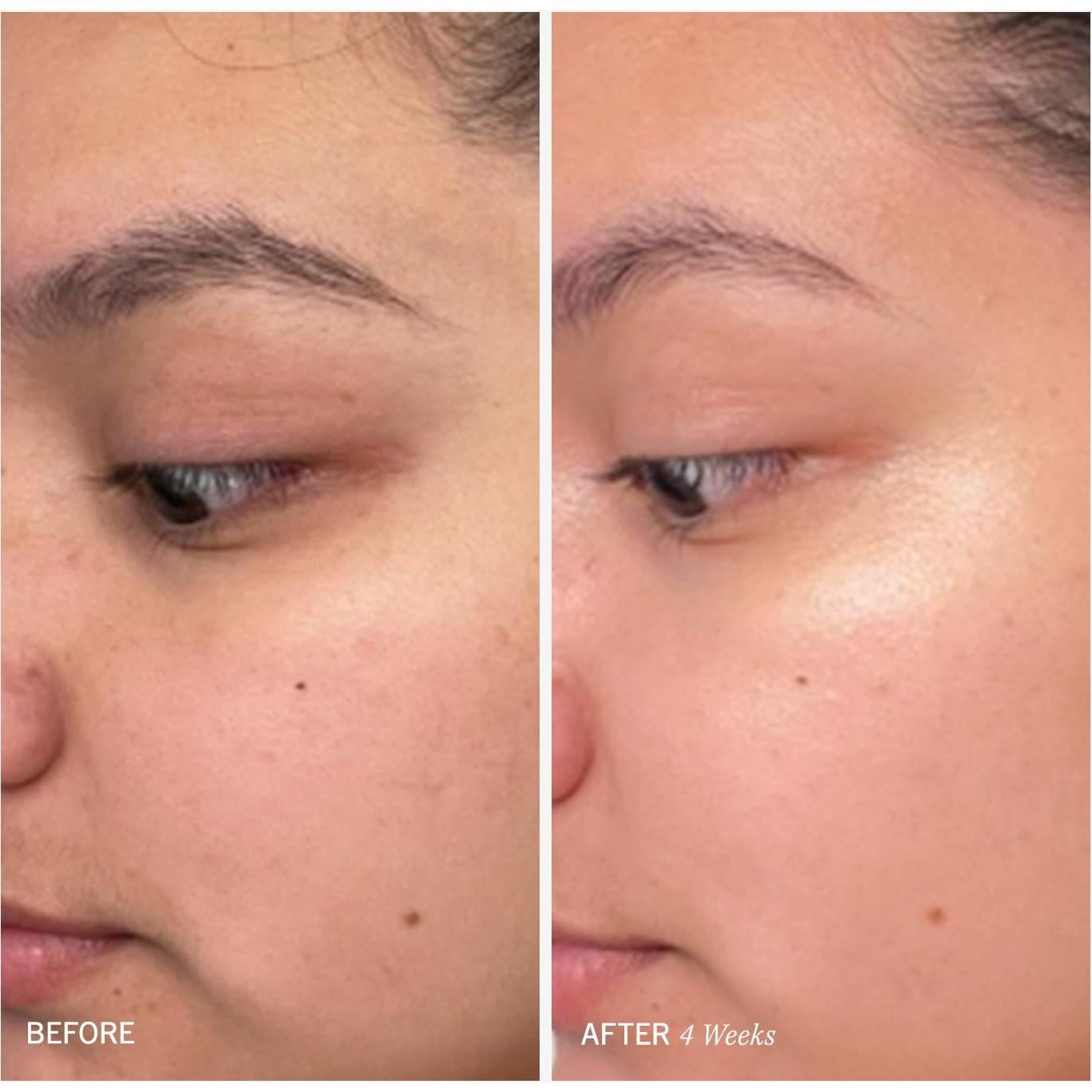 Almohadillas Exfoliantes Faciales First Aid Beauty - 28 Unidades