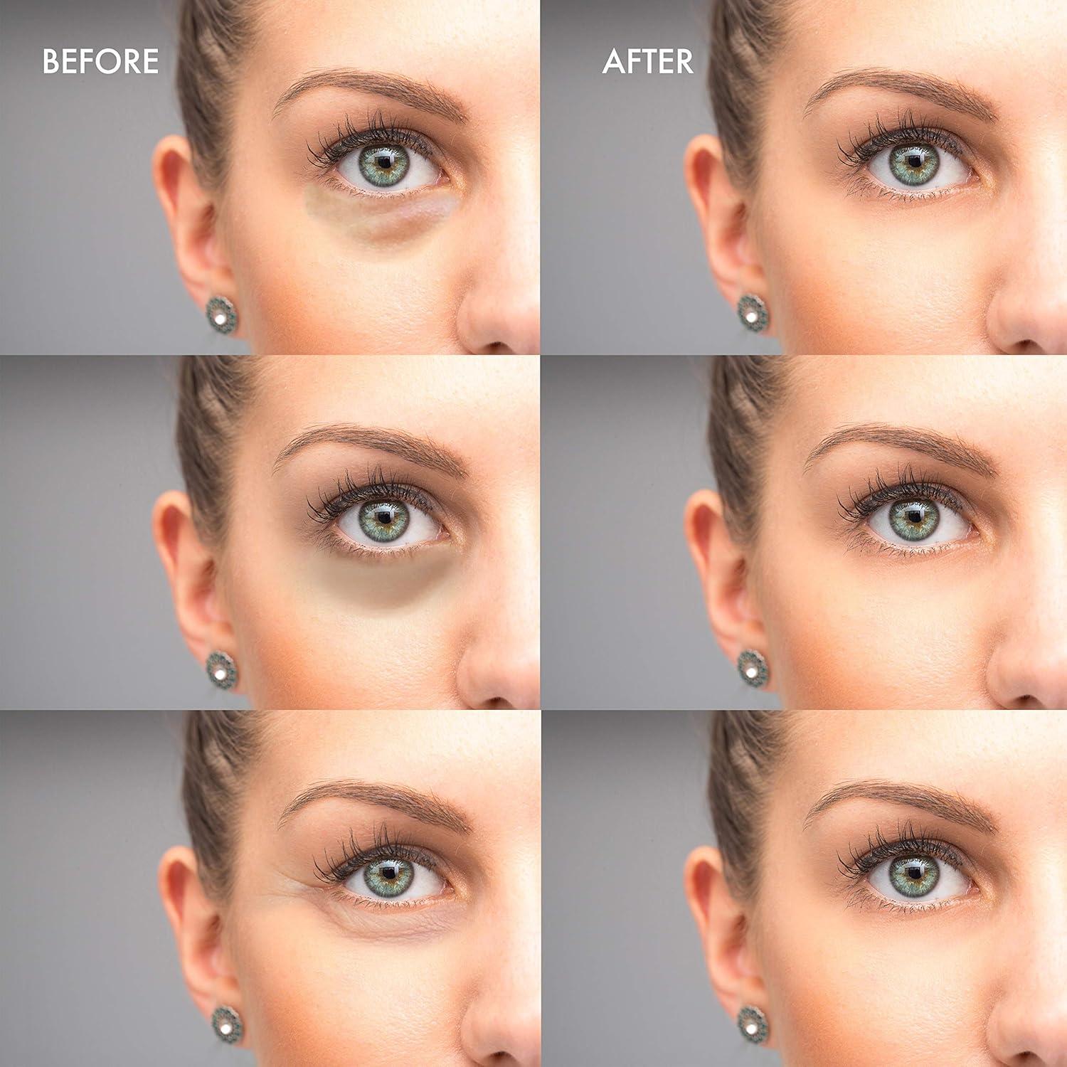 Mascarilla Hidratante para Ojos My Alle Care Aloe Vera 30 Pares