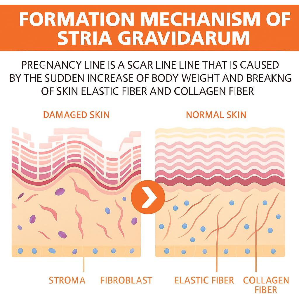 Crema para Estrías TRSTAY - Natural con Vitamina E y Glicerina 15g