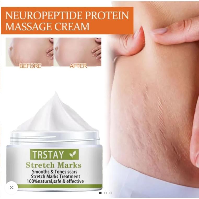 Crema para Estrías TRSTAY - Natural con Vitamina E y Glicerina 15g
