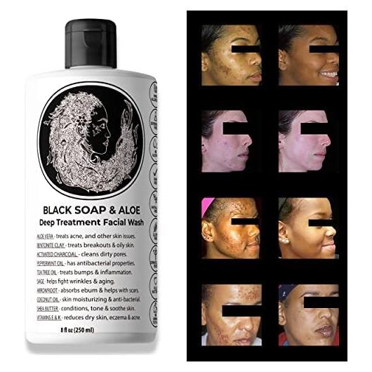 Jabón Negro Natural con Aloe 226g - Limpieza Profunda Facial