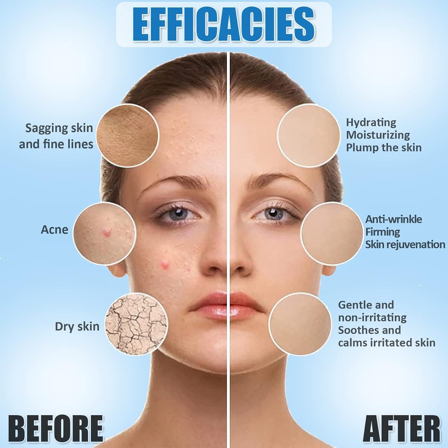 Set de Cuidado de la Piel YMEYFAN 5 Productos 500ml Hipoalergénico