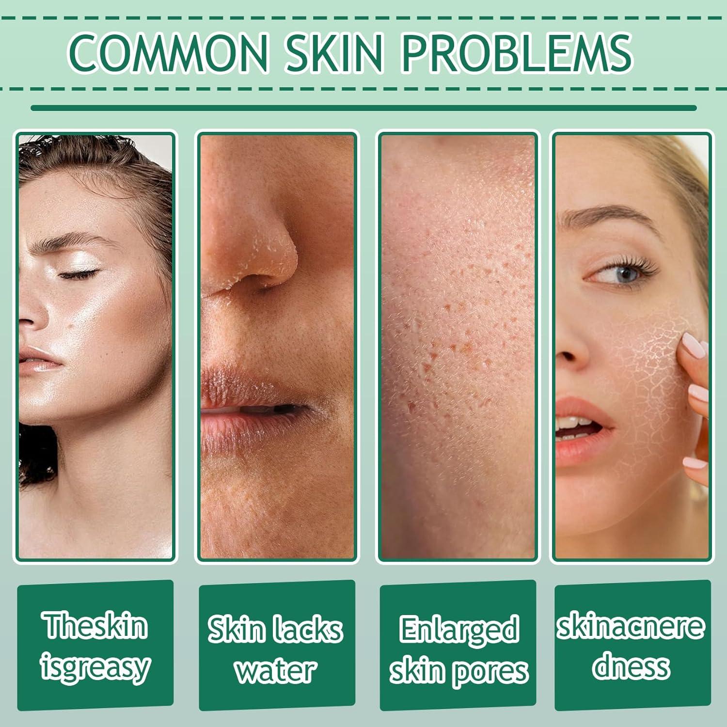 Kit de Cuidado de Piel Aloe Vera DWDiWen 9 Piezas Hidratante