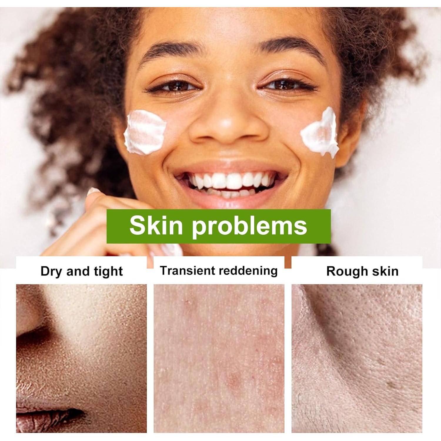 Crema Facial Hidratante Aloe Vera 98% WHHWM 50ml Antienvejecimiento