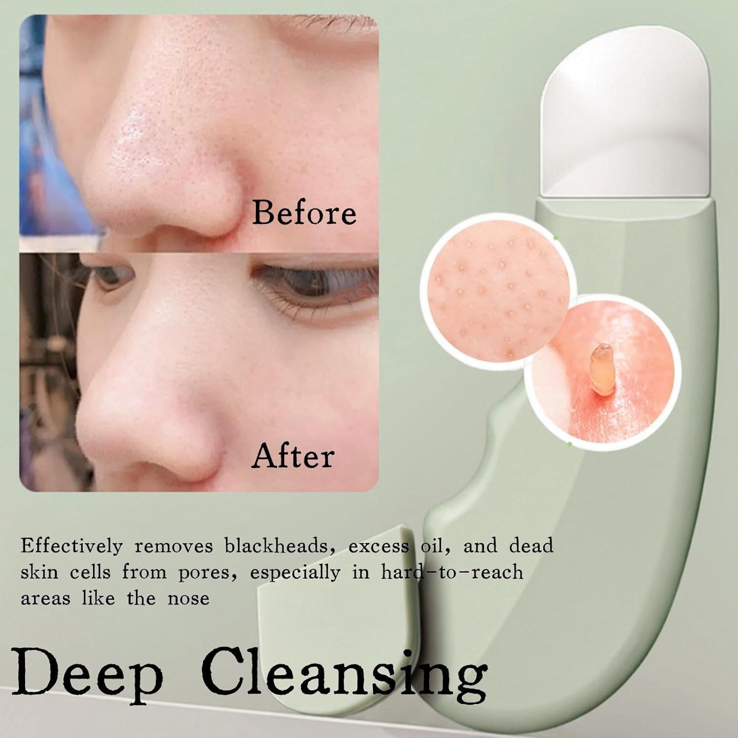 Blackhead Remover Tool, Reusable Face Spatula Scrubber for Deep Cleansing, Skin Care Tool for Men and Women, Green