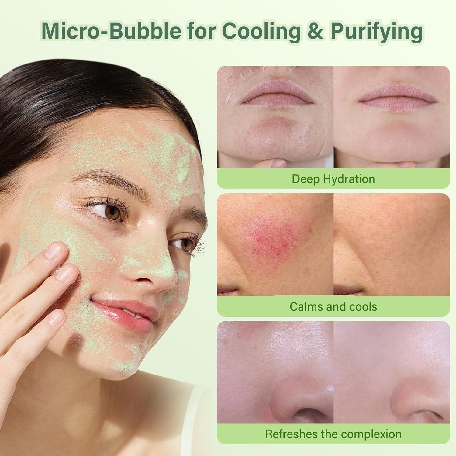 Mascarilla Facial de Gel de Aloe Vera SPRINGSKY 100g Hidratante