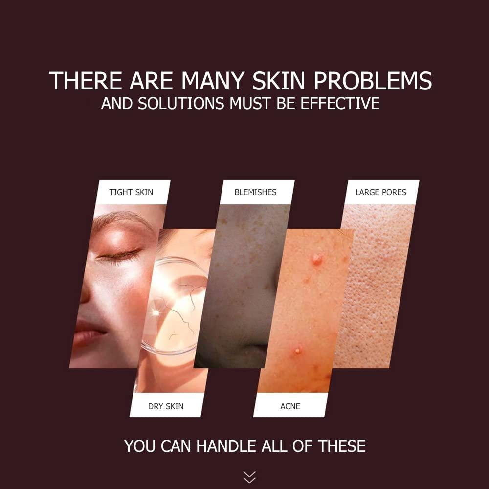 Gel Hidratante BIOAQUA Aloe Vera Rosa 300g - Cuidado de Piel