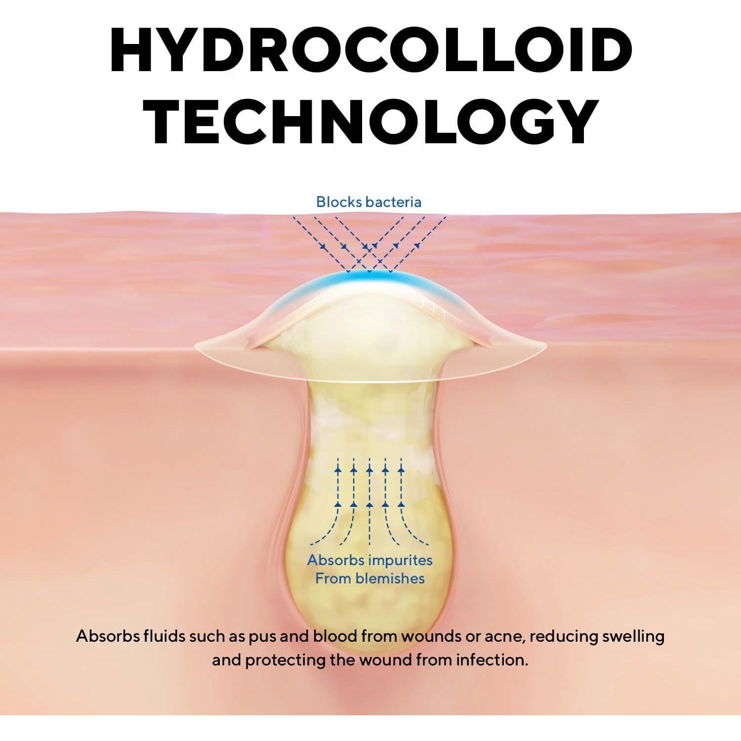 Parches Hidrocoloides para Granitos Caraseoul - 44 Unidades