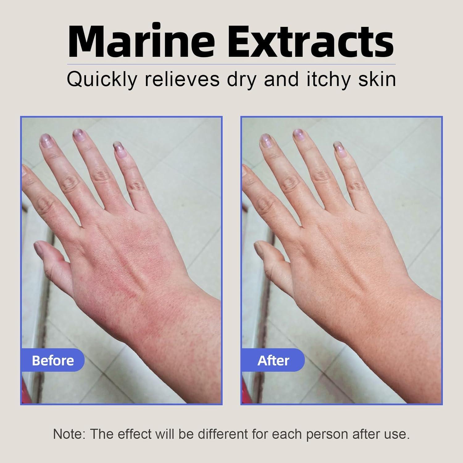 Crema Calmante para Eccema Crogooe 140g - Natural con Aloe Vera