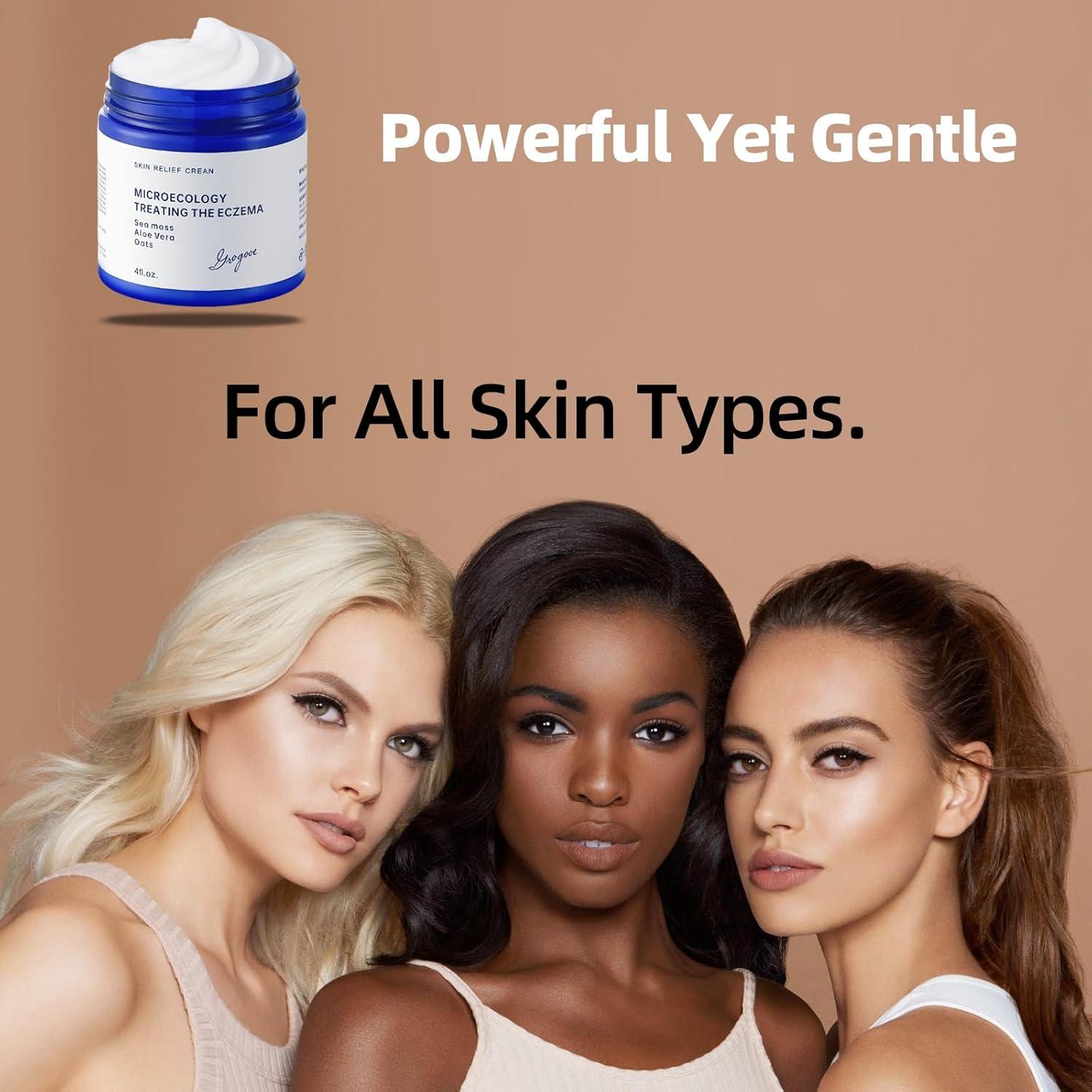 Crema Calmante para Eccema Crogooe 140g - Natural con Aloe Vera