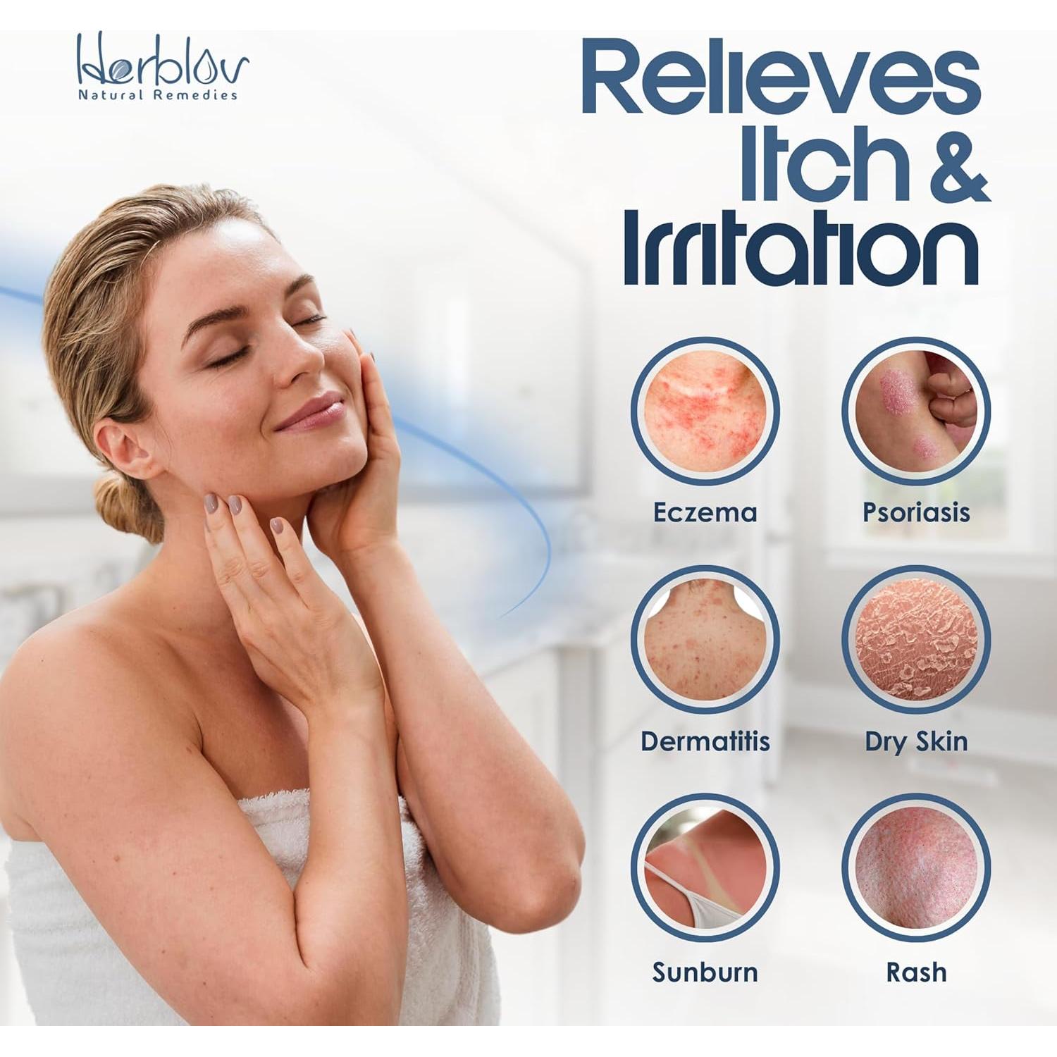 Jabón Natural para Eczema Herblov - Alivio Piel Seca 160g