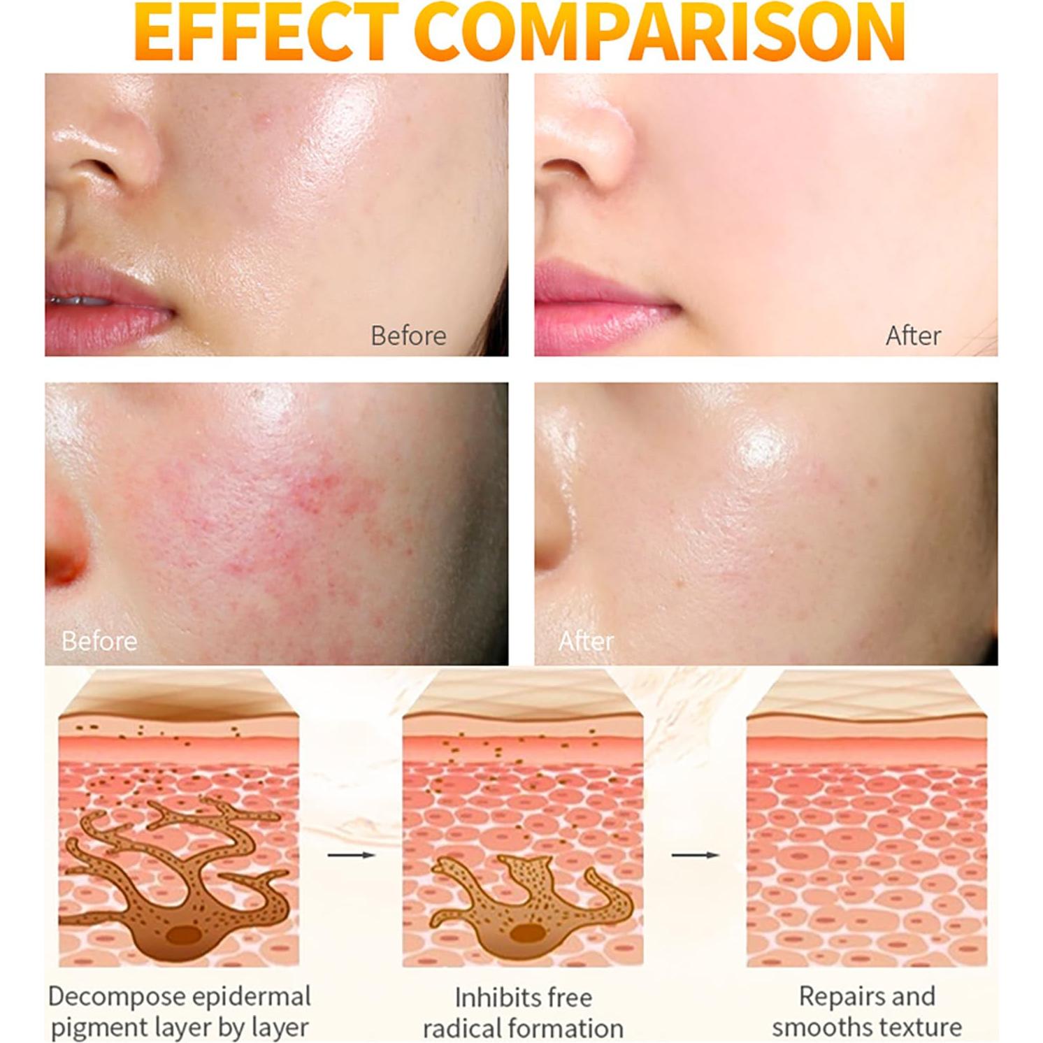 Crema Hidratante Reparadora Disaar 120g Vitamina C Arbutina