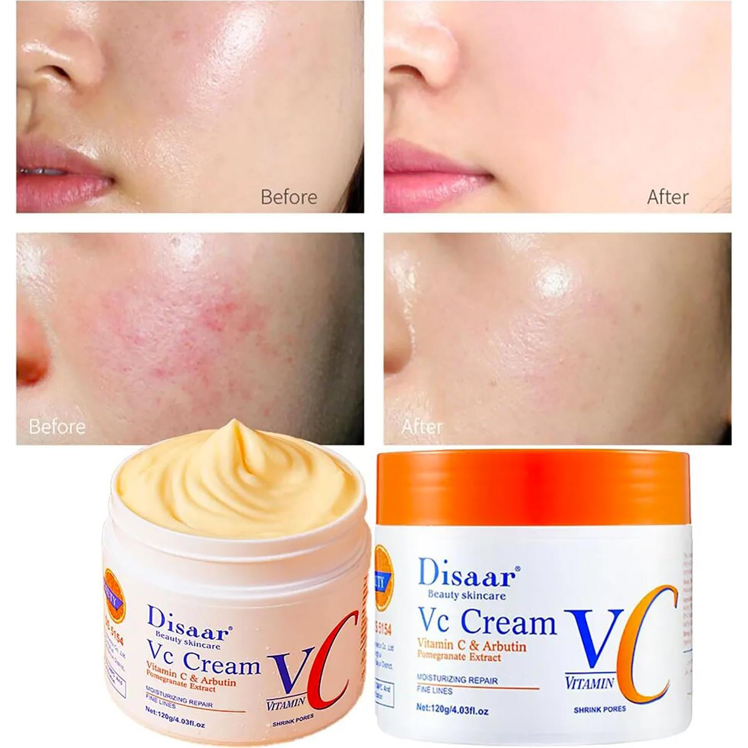 Crema Hidratante Reparadora Disaar 120g Vitamina C Arbutina