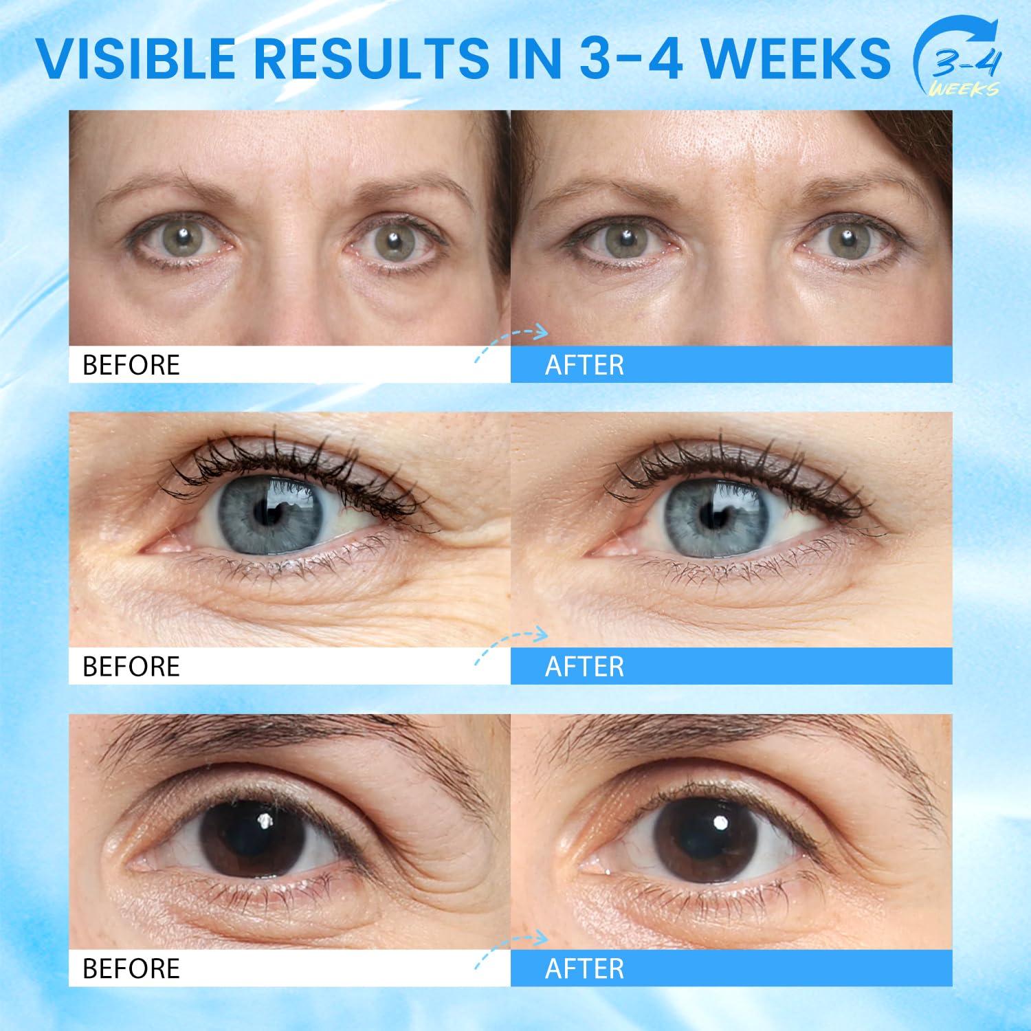 Barra de Ojos con Cafeína - Hidratante y Antiarrugas 15cm