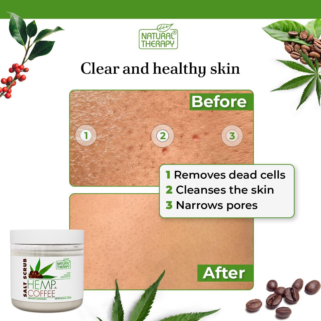 Exfoliante Corporal de Sal de Cánamo y Café 660g - Salud y Belleza Cristalina