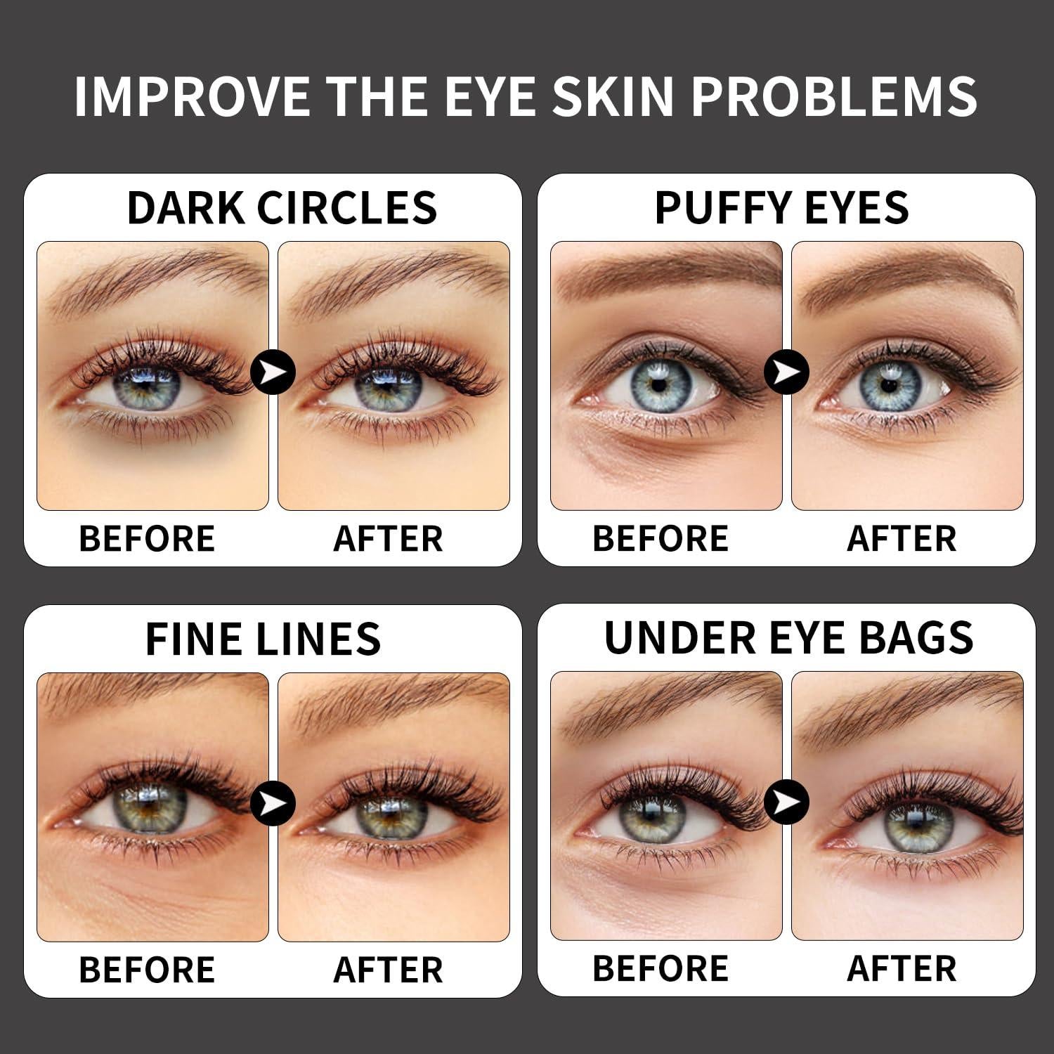 Parches de Colágeno para Ojos ROUSE - 20 Pares con Cafeína