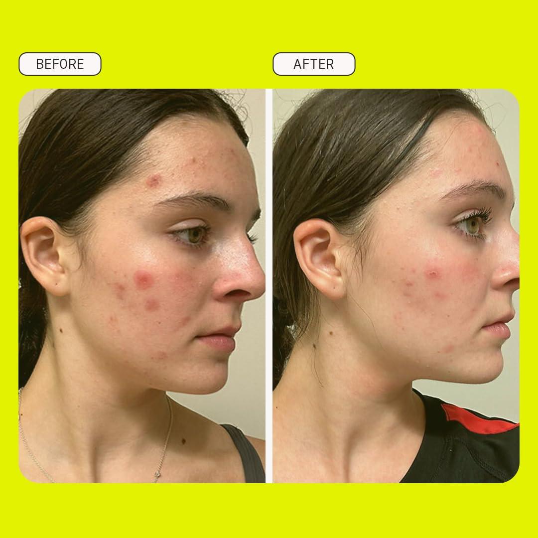 Colección Cuidado de la Piel Preppy Evereden - Limpiador, Hidratante y Almohadillas