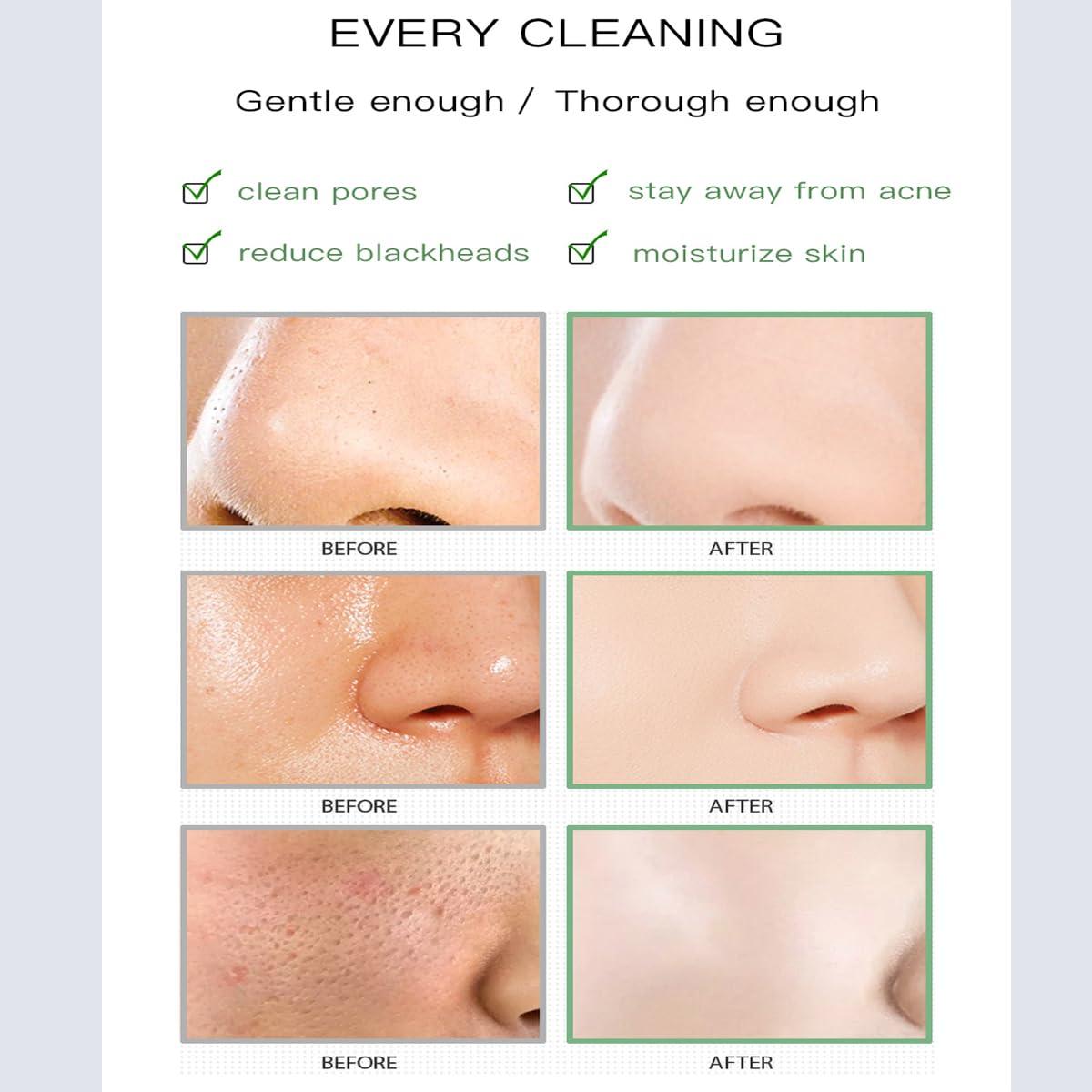 Barra de Mascarilla Limpieza Profunda WenFeng con Té Verde 2PCS