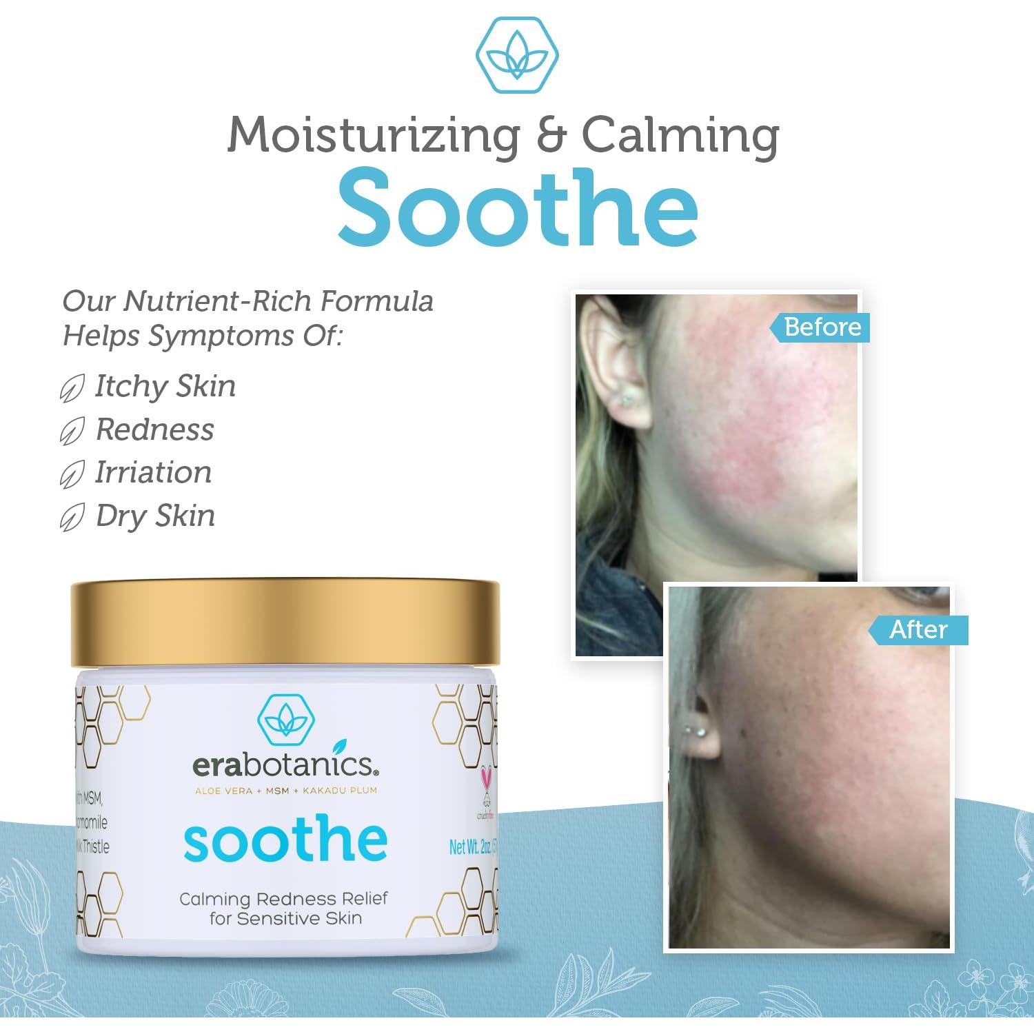 Crema Hidratante Era Organics para Enrojecimiento 56.7g