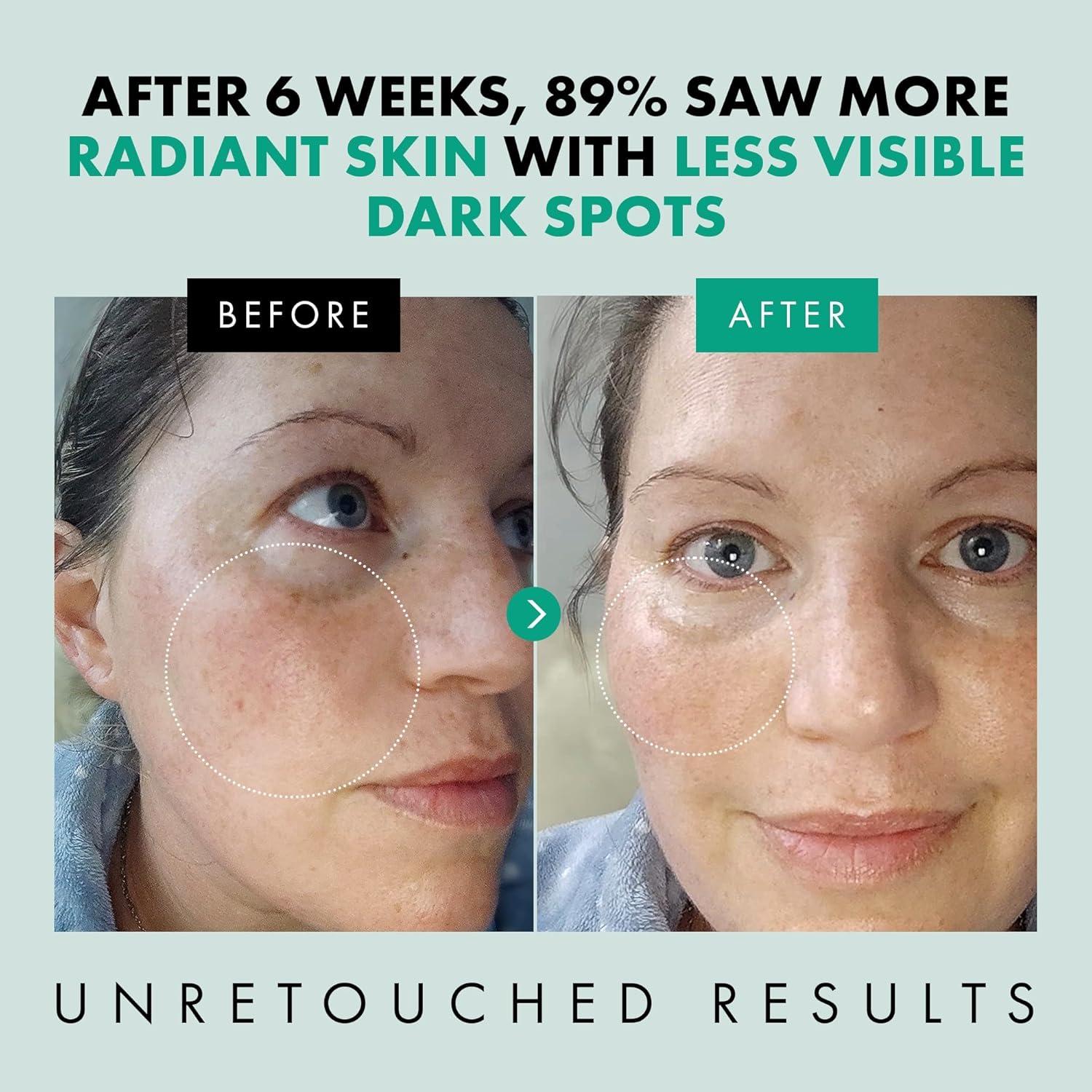 Suero de Niacinamida Eclat Skincare 29.57 ml - Iluminador y Minimizador de Poros