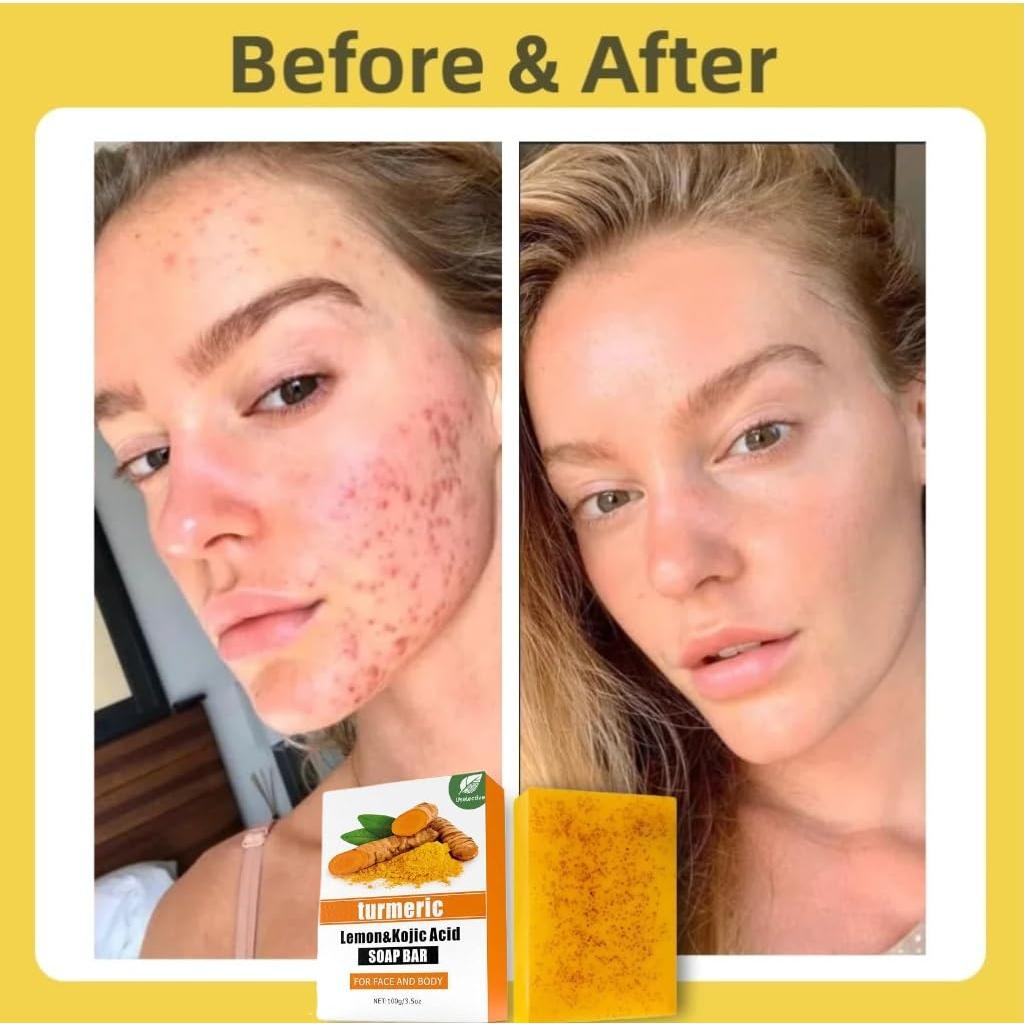 Jabón Natural de Limón y Cúrcuma Beauty Beauty - 100g