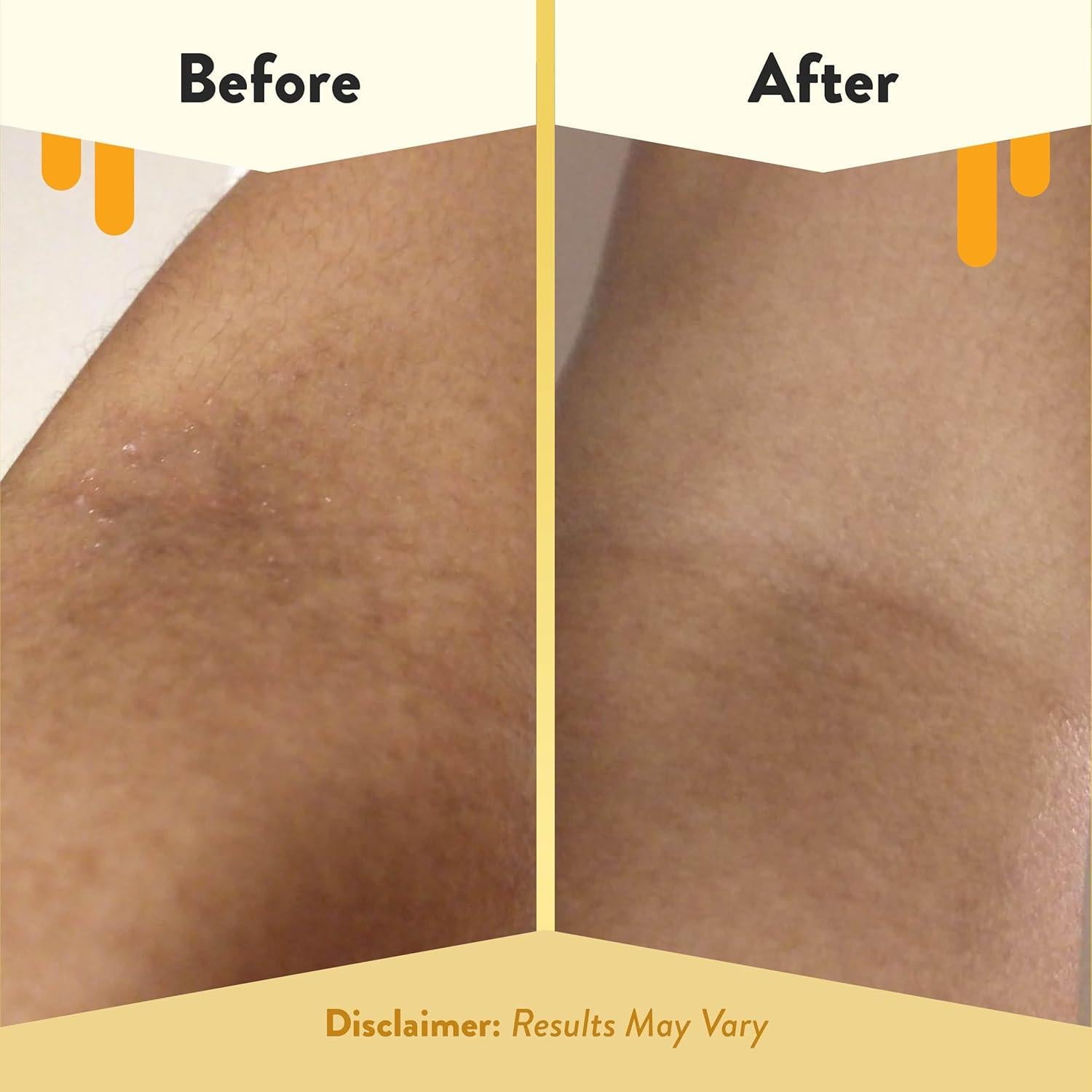 Baño de Burbuja de Avena Eczema Honey 340g - Gel de Ducha Sin Fragancia