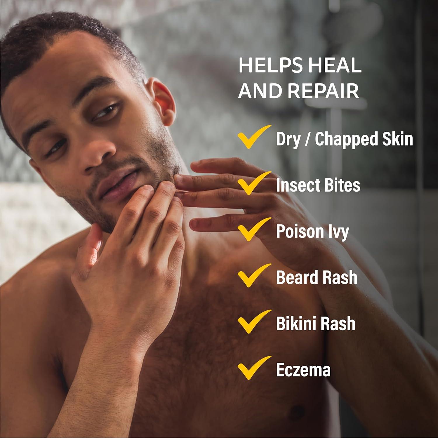 Ungüento Medicado A+D para Erupciones 42 g - Alivio Piel Irritada