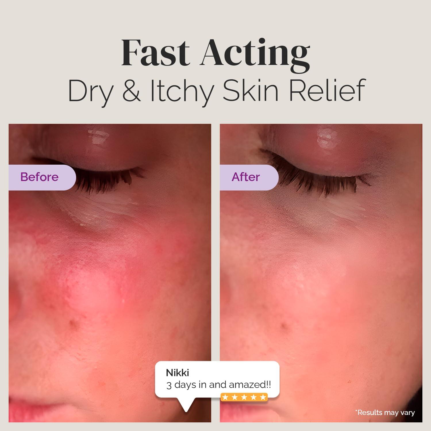 Crema Hidratante Puriya 127.57 g - Alivio Piel Seca y Picazón