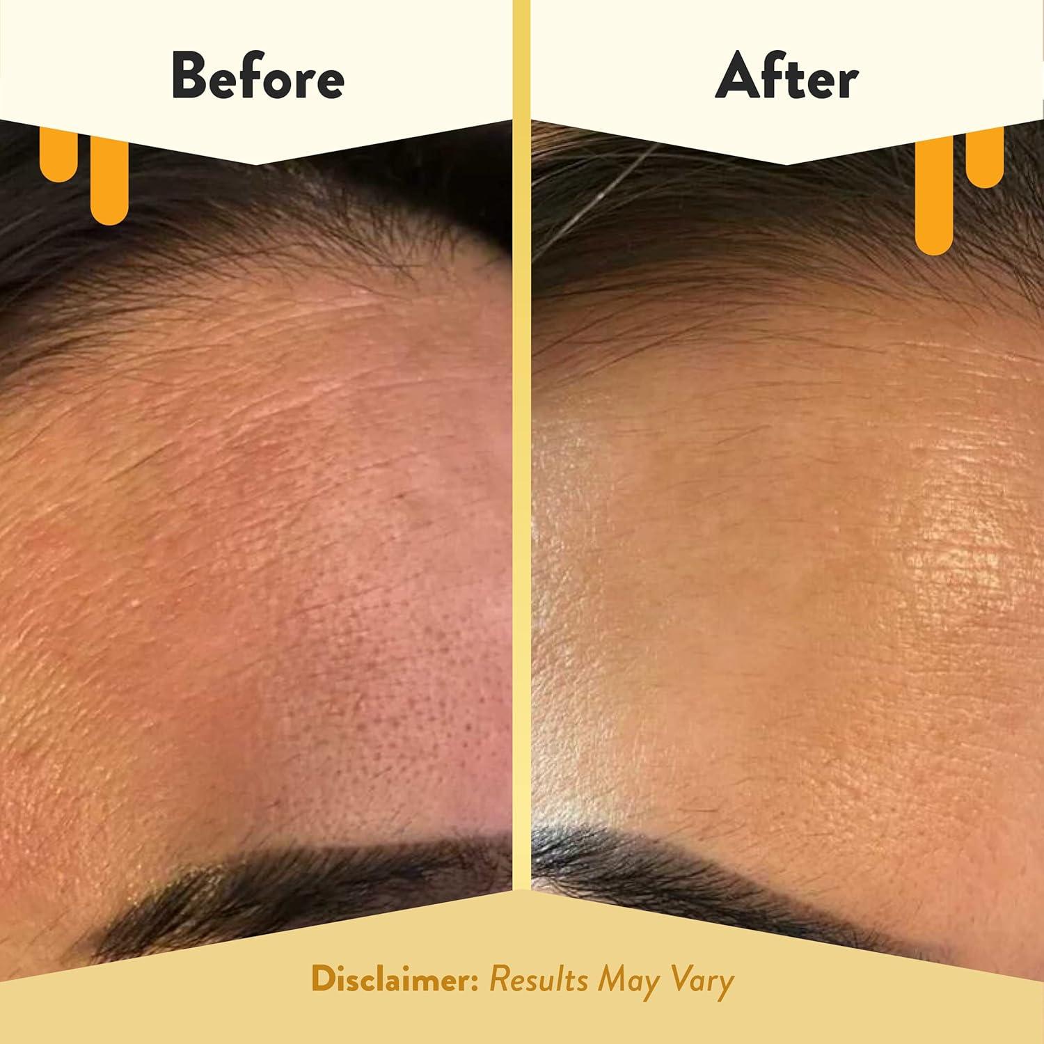 Crema Renovadora Nocturna Eczema Honey 99 g - Hidratante Facial