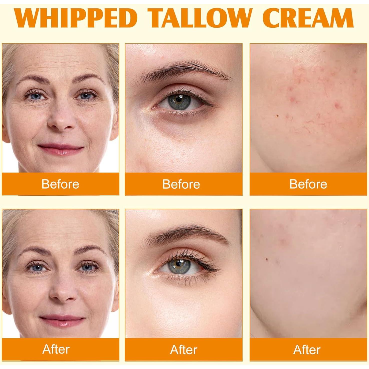 Bálsamo Hidratante Facial de Grasa de Res Meifenla 120g