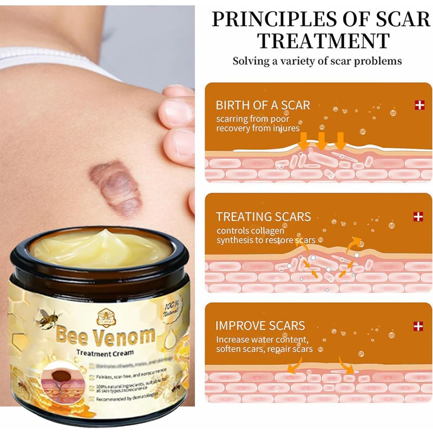 Crema Tratamiento Piel con Veneno de Abeja Luhaka 40g