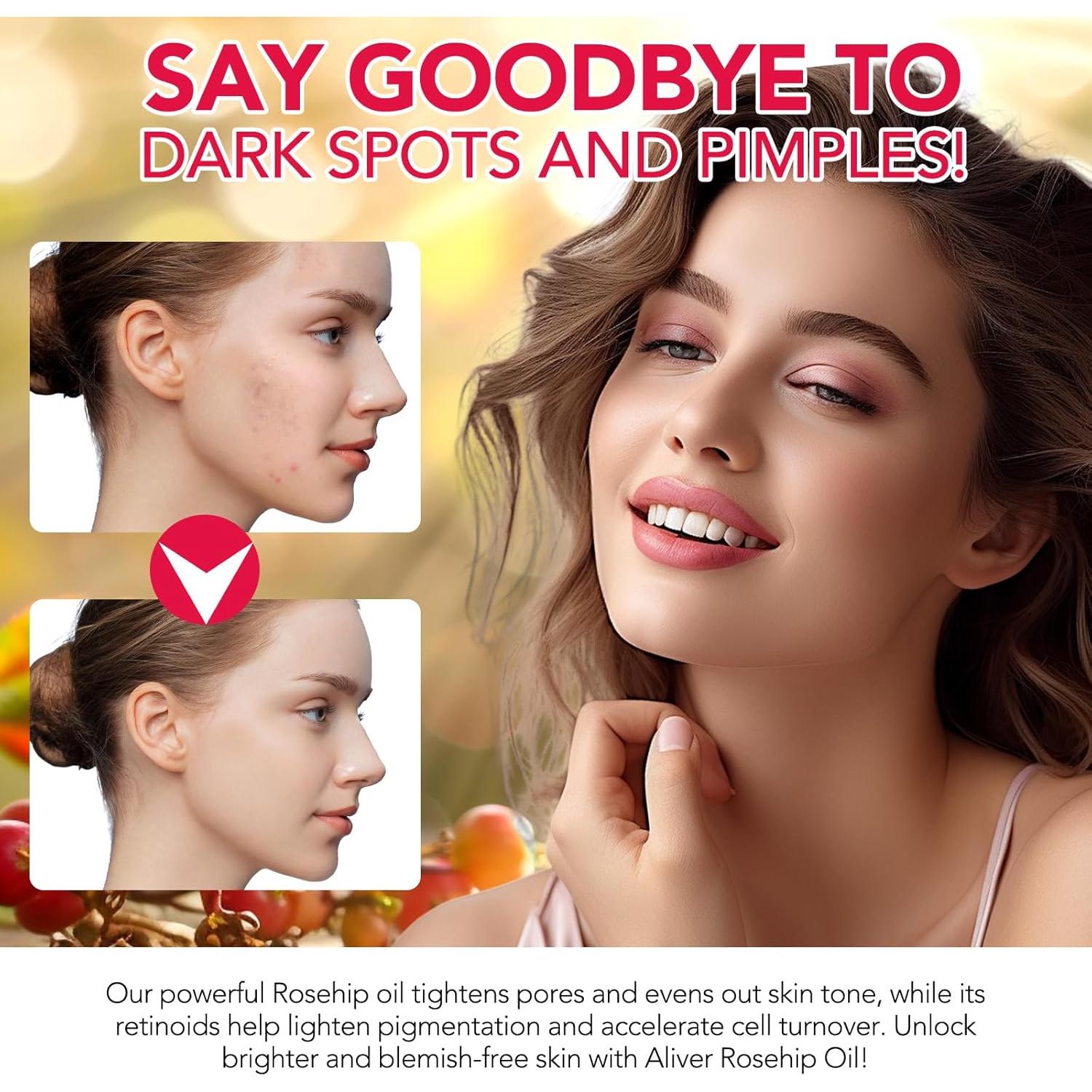 Aceite de Rosa Mosqueta 100% Puro 59.15 ml - Hidratante Facial y Capilar