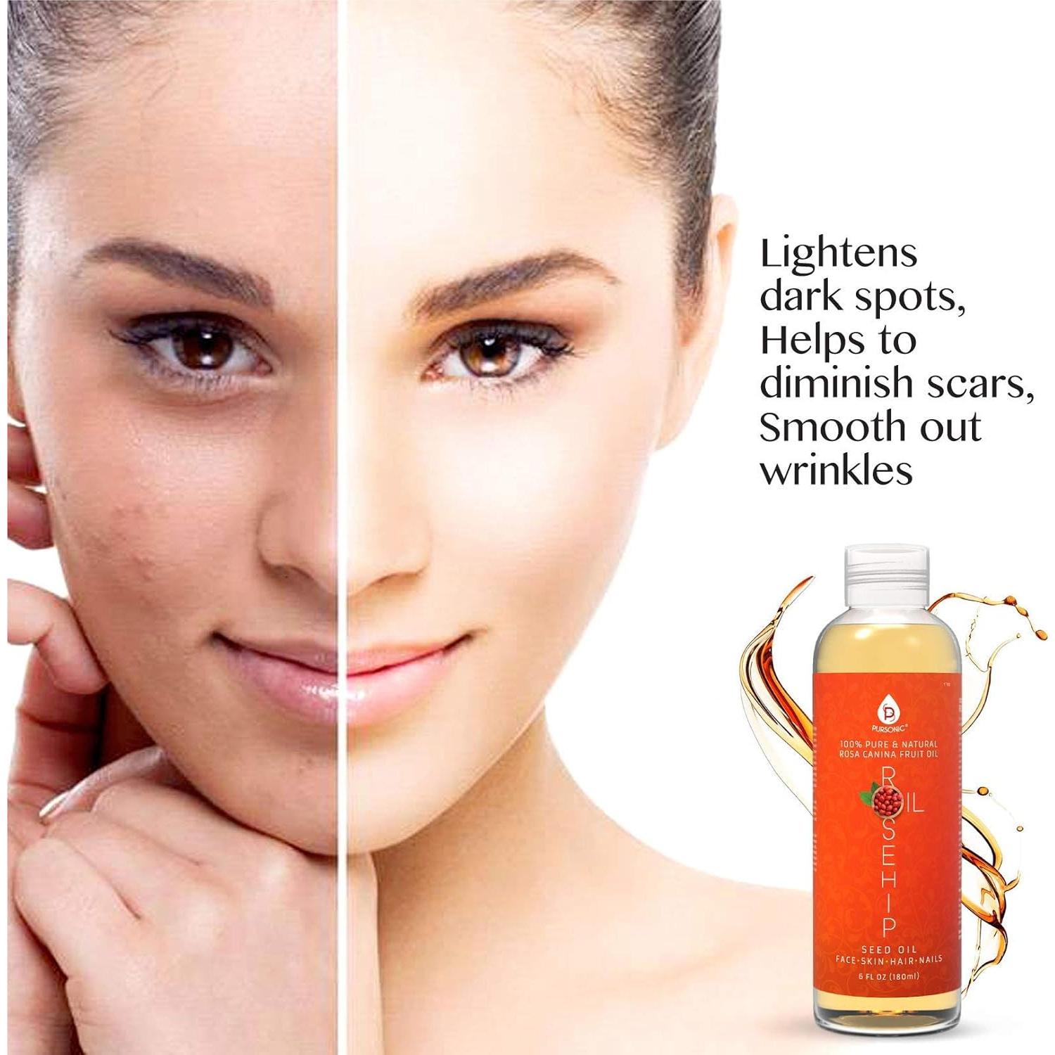 Aceite de Rosa Mosqueta Pursonic 170 ml - Hidratante Facial Antienvejecimiento