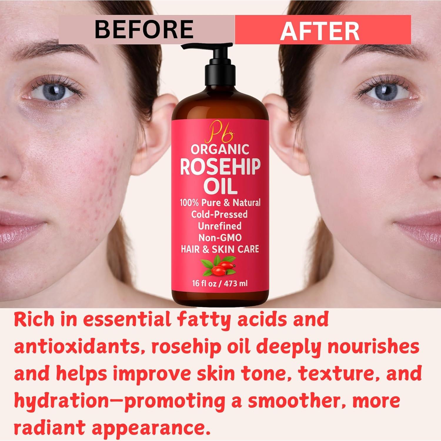 Aceite de Rosa Mosqueta Orgánico 473 ml - Puro y Prensado en Frío