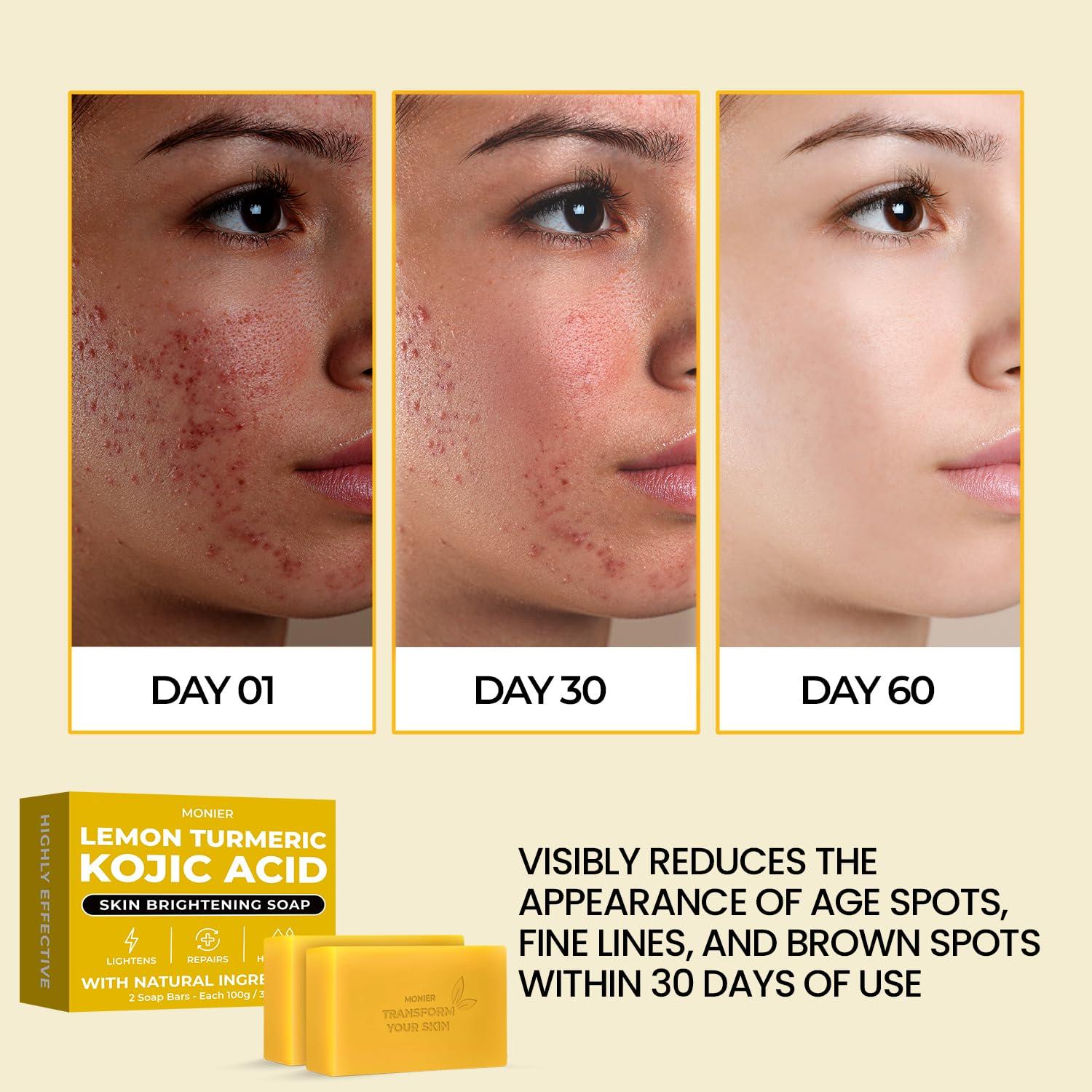 Jabón de Ácido Kójico MONIER con Limón y Cúrcuma - 2 Unidades