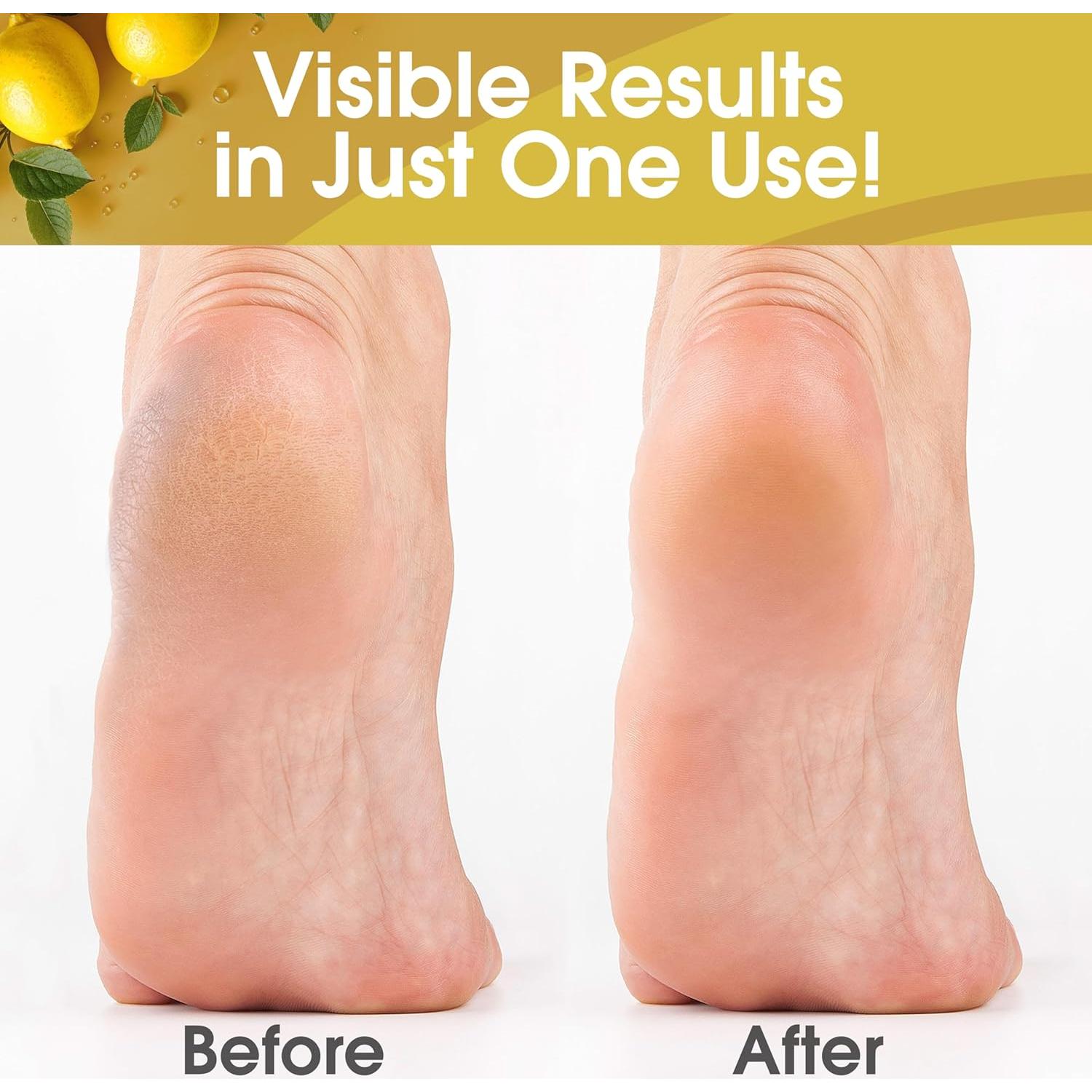 Gel Removedor de Callos DeEnti 453g Limón - Fuerza Extra