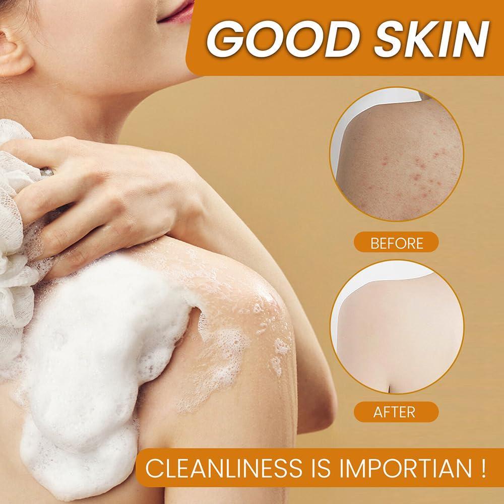 Juego de Cuidado Facial Derperzi: Gel de Cúrcuma y Jabón