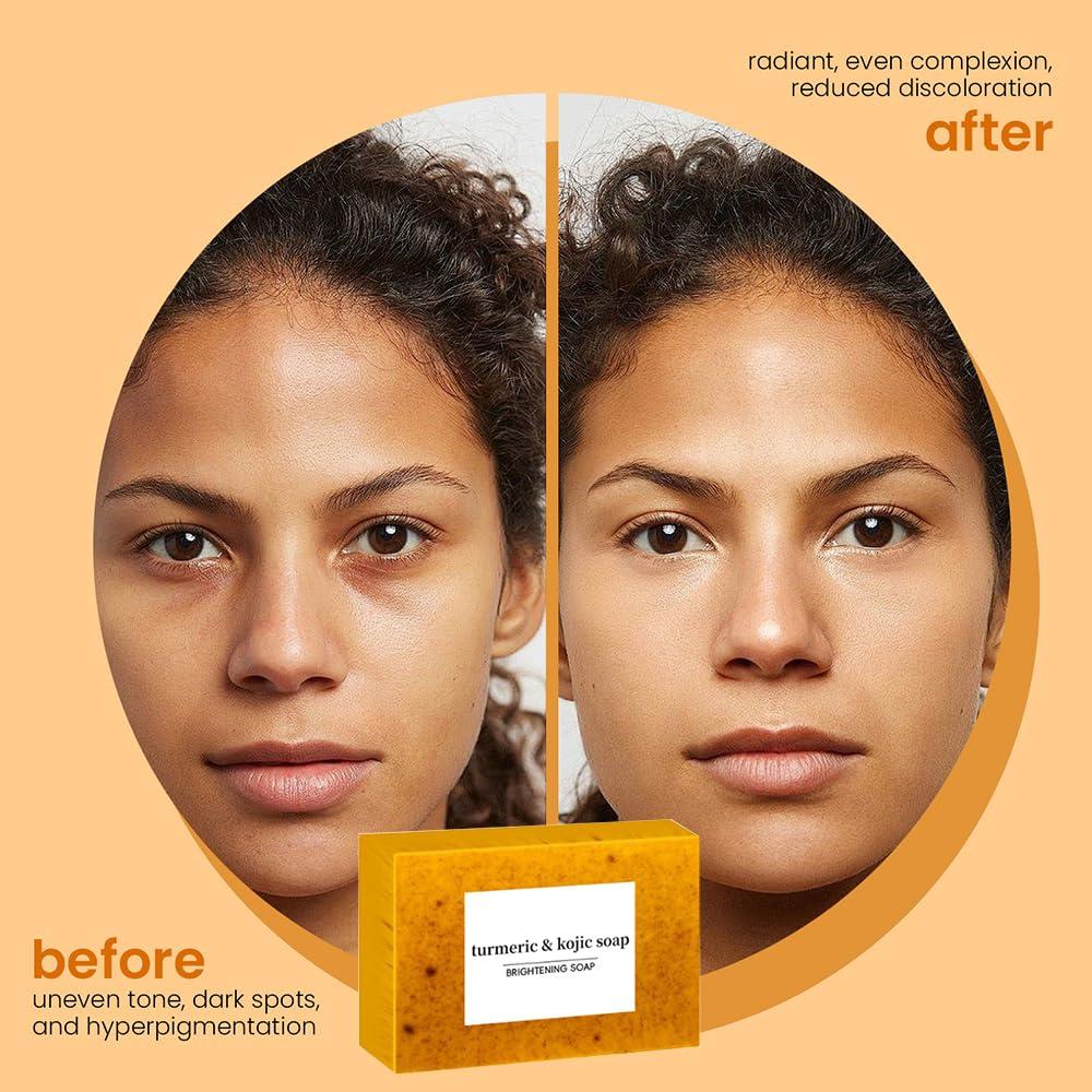 Juego de Cuidado Facial Derperzi: Gel de Cúrcuma y Jabón