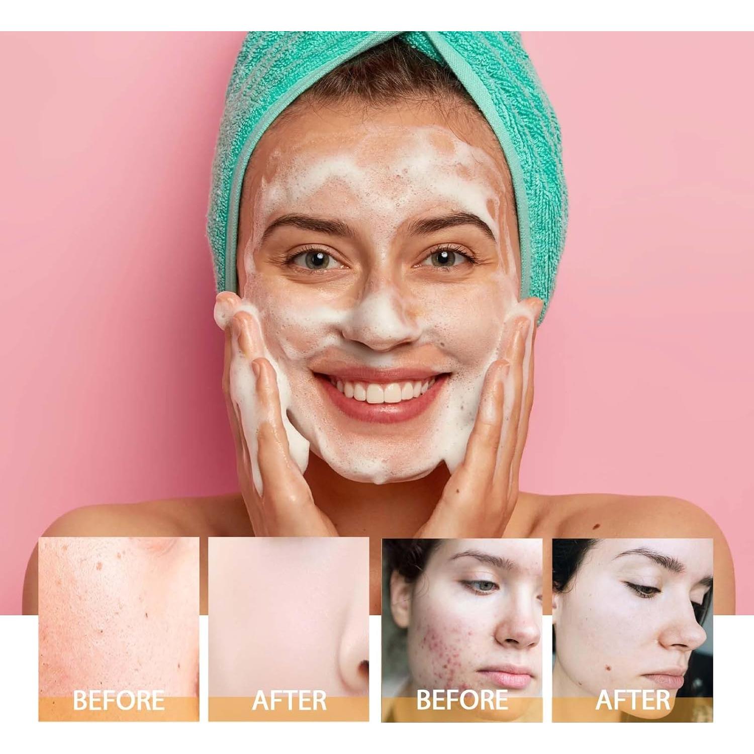 Limpiador Facial de Cúrcuma JISKG 2 Pcs Exfoliación Suave