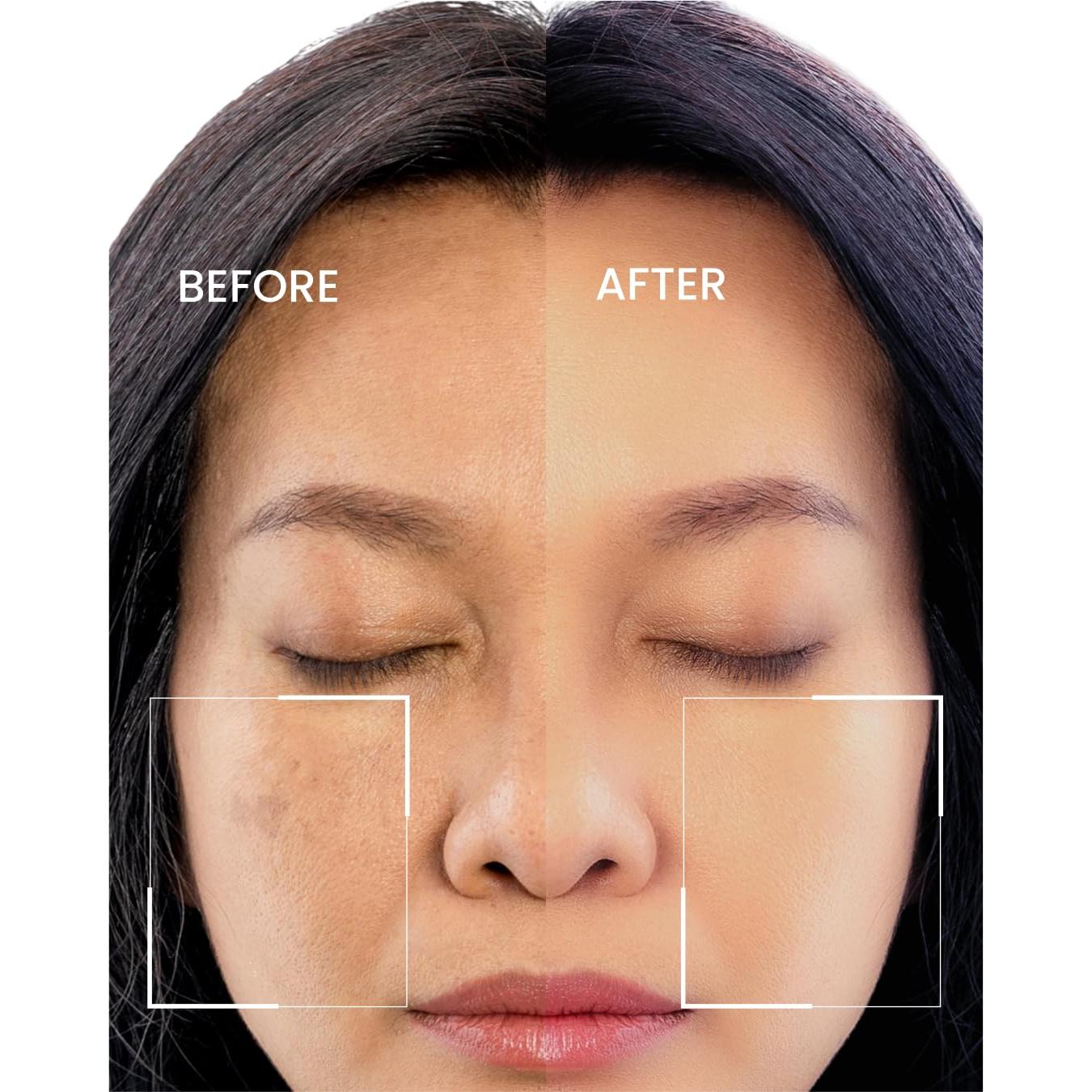 Suero Antienvejecimiento Eliré con Ácido Hialurónico 30ml