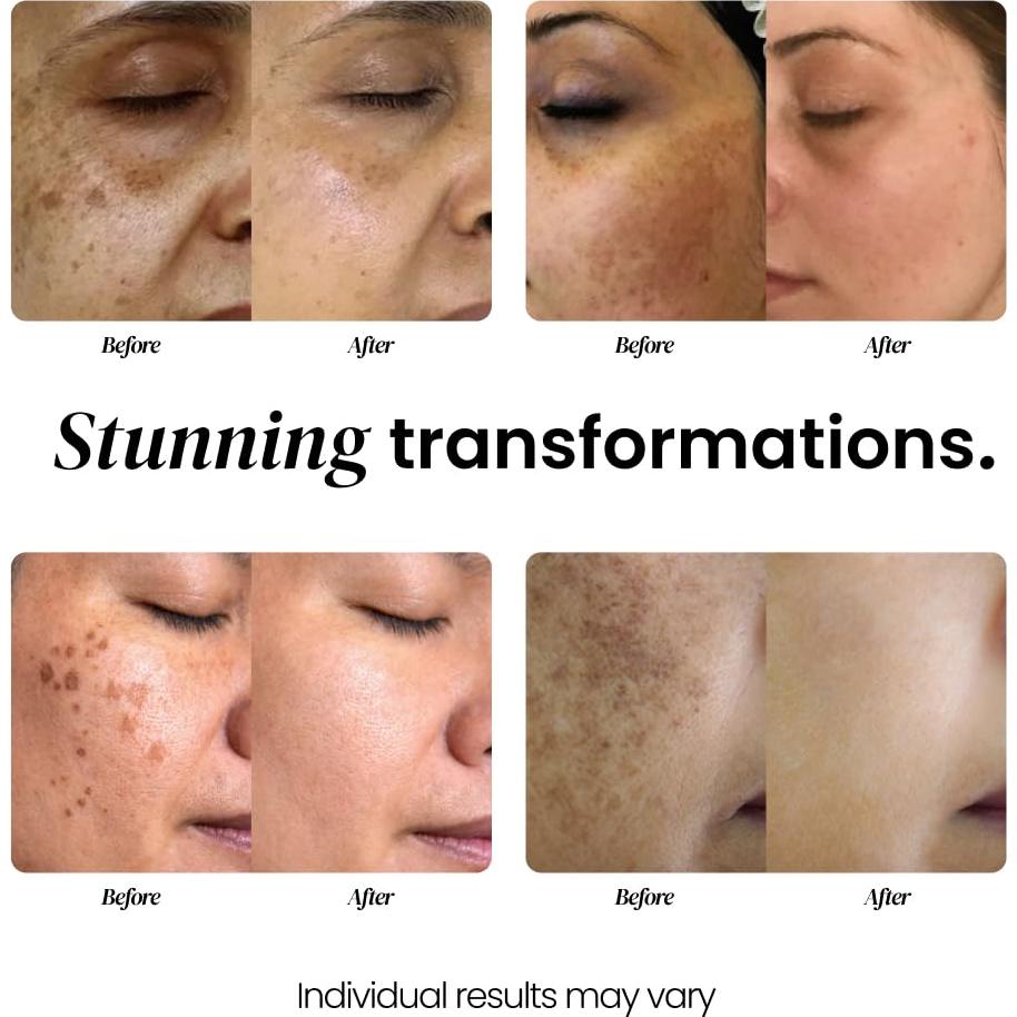 Suero Antienvejecimiento Eliré con Ácido Hialurónico 30ml