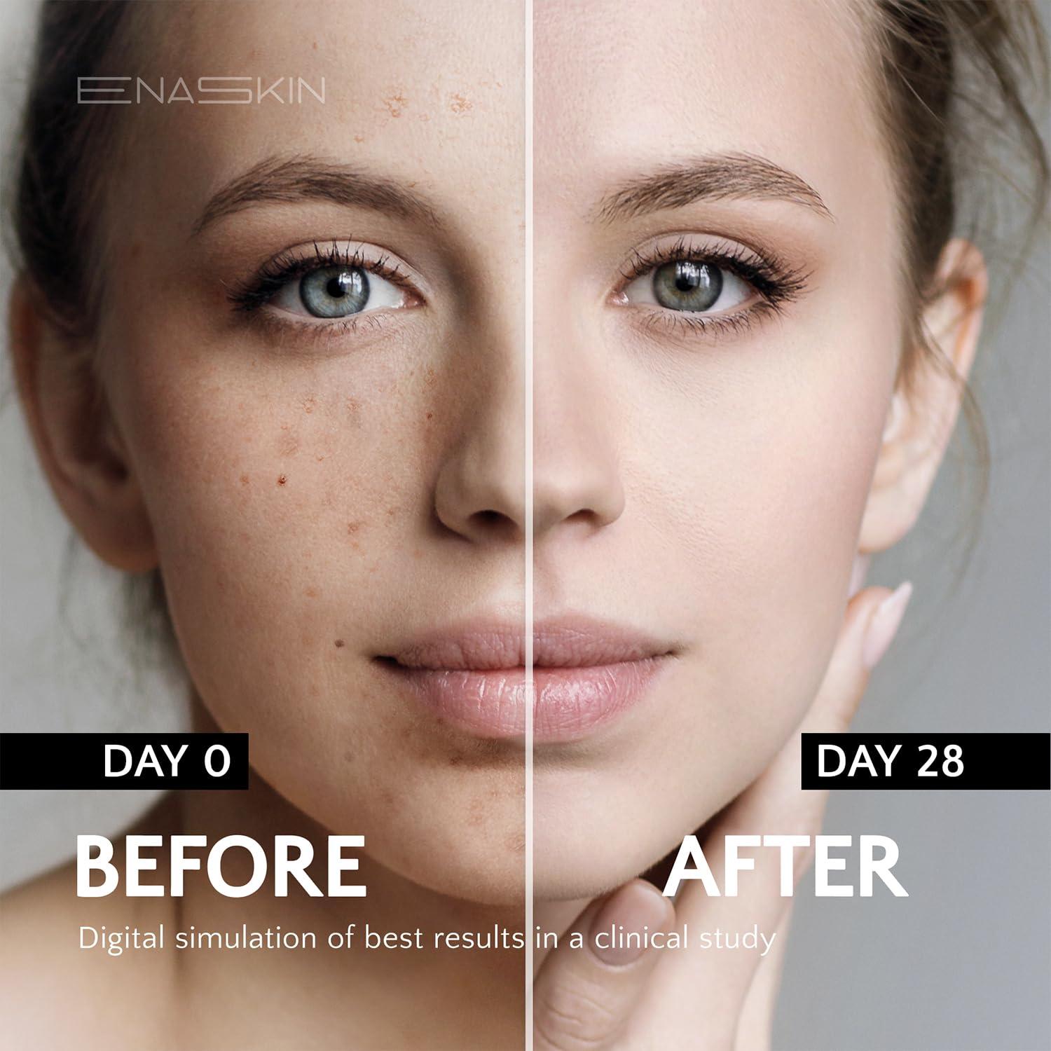 EnaSkin Crema Removedora de Manchas Oscuras 50ml para Cara y Cuerpo