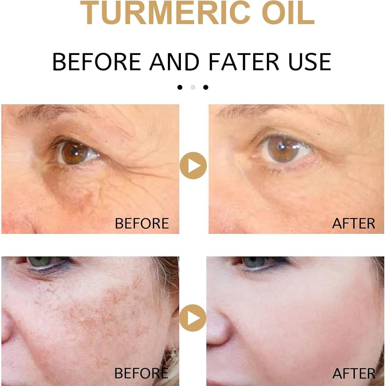 Suero Facial Hidratante Aiwenchen Cúrcuma 30ml 3PCS