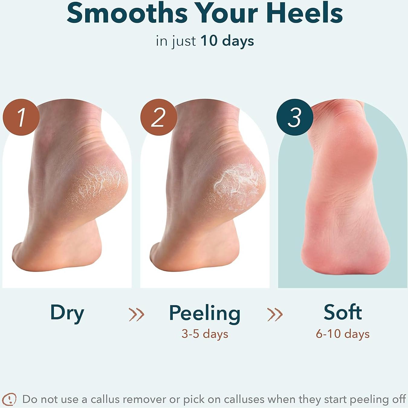 Mascarilla Exfoliante para Talones Purederm - 1 Par