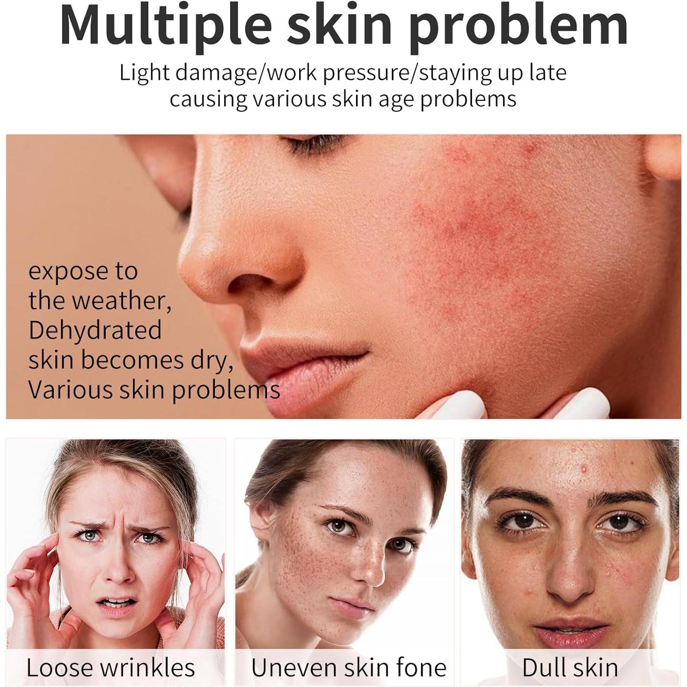 Juego de 12 Mascarillas Faciales Hidratantes GUOYAOLIFU