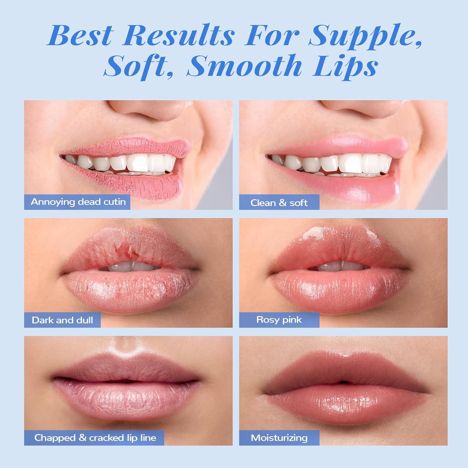 Conjunto de Cuidado Labial ANAI RUI - Exfoliante y Mascarilla