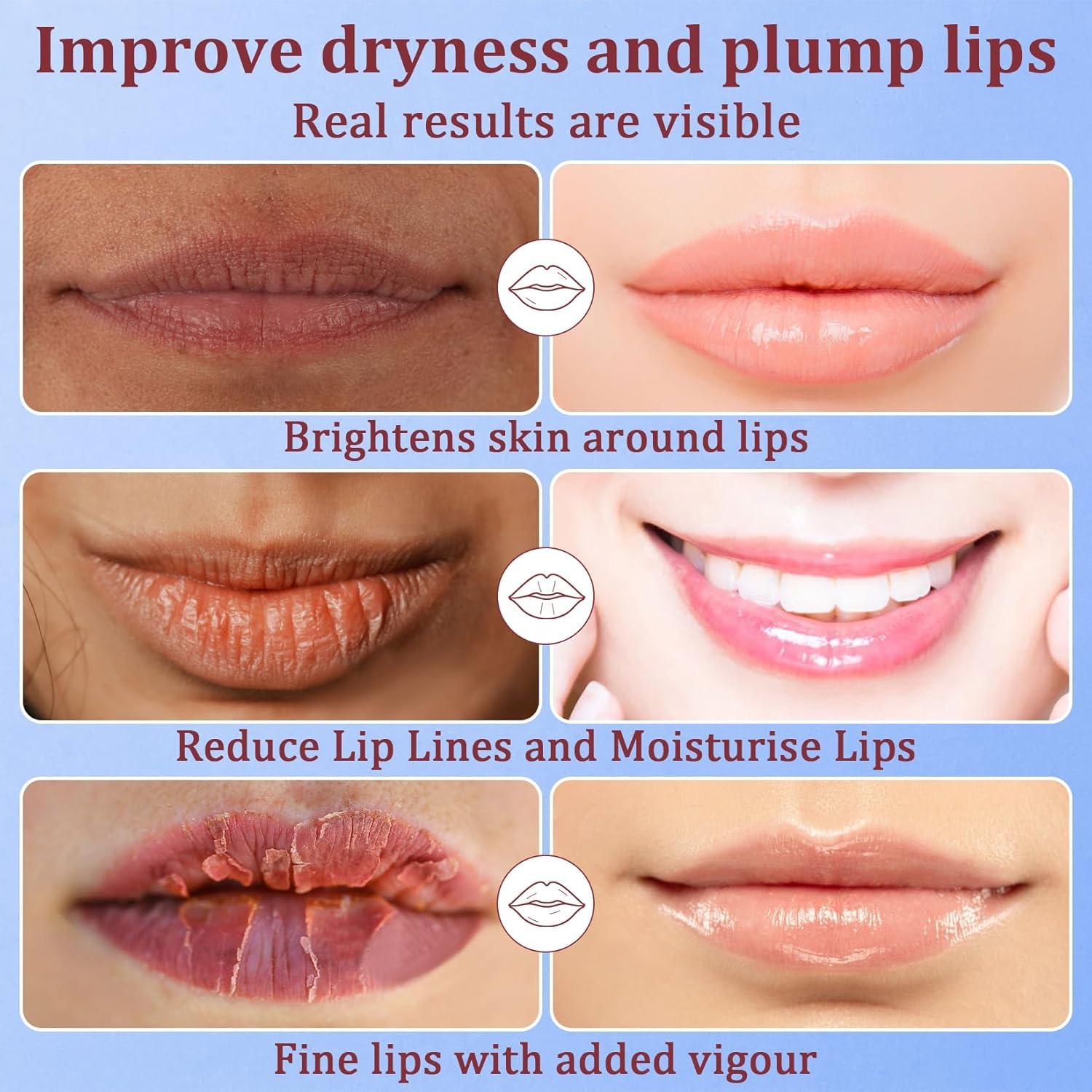 30 Mascarillas Hidratantes Labiales YM - Gel Anti-arrugas y Sequedad