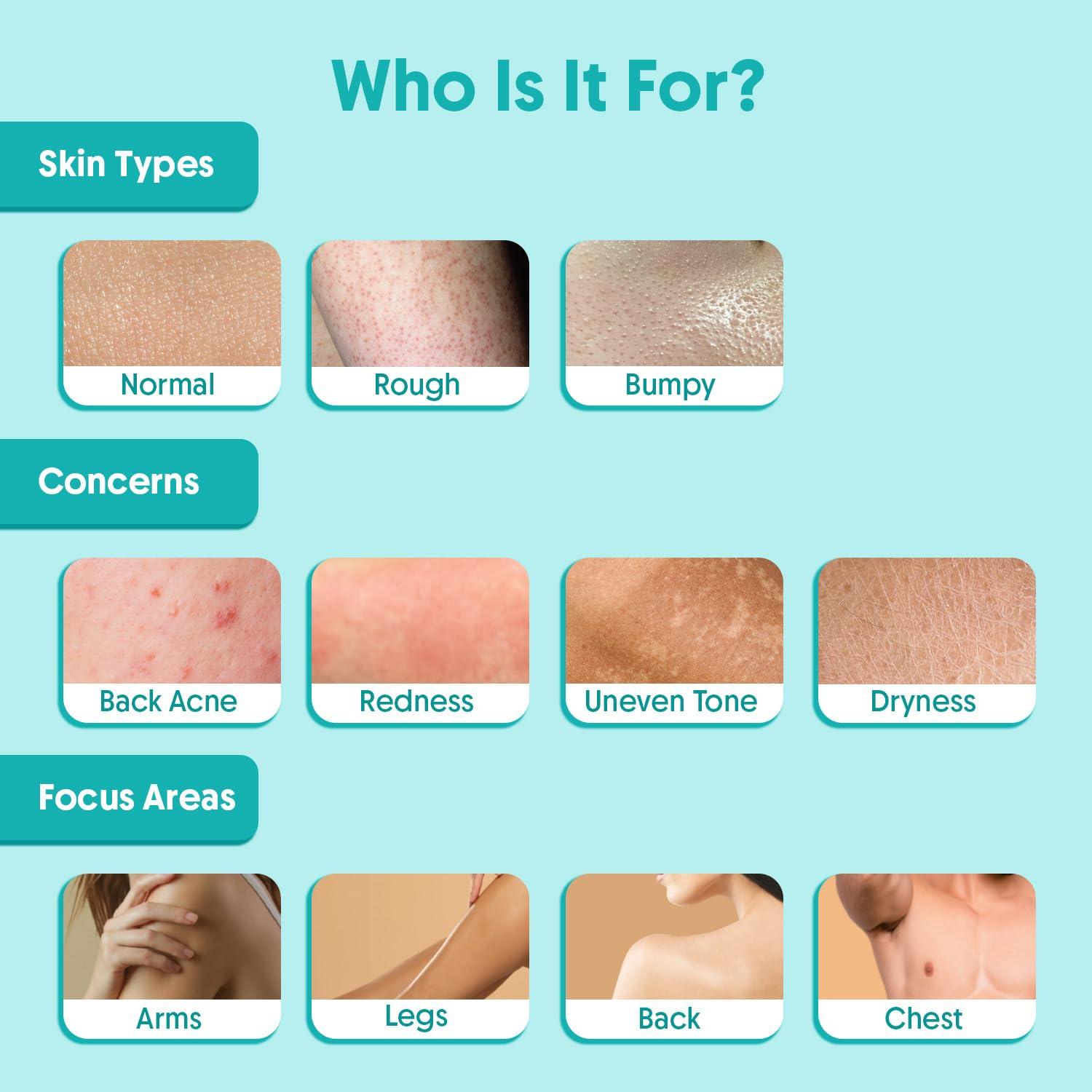 Gel de Ducha Exfoliante 2% Ácido Salicílico TRD 300 ml