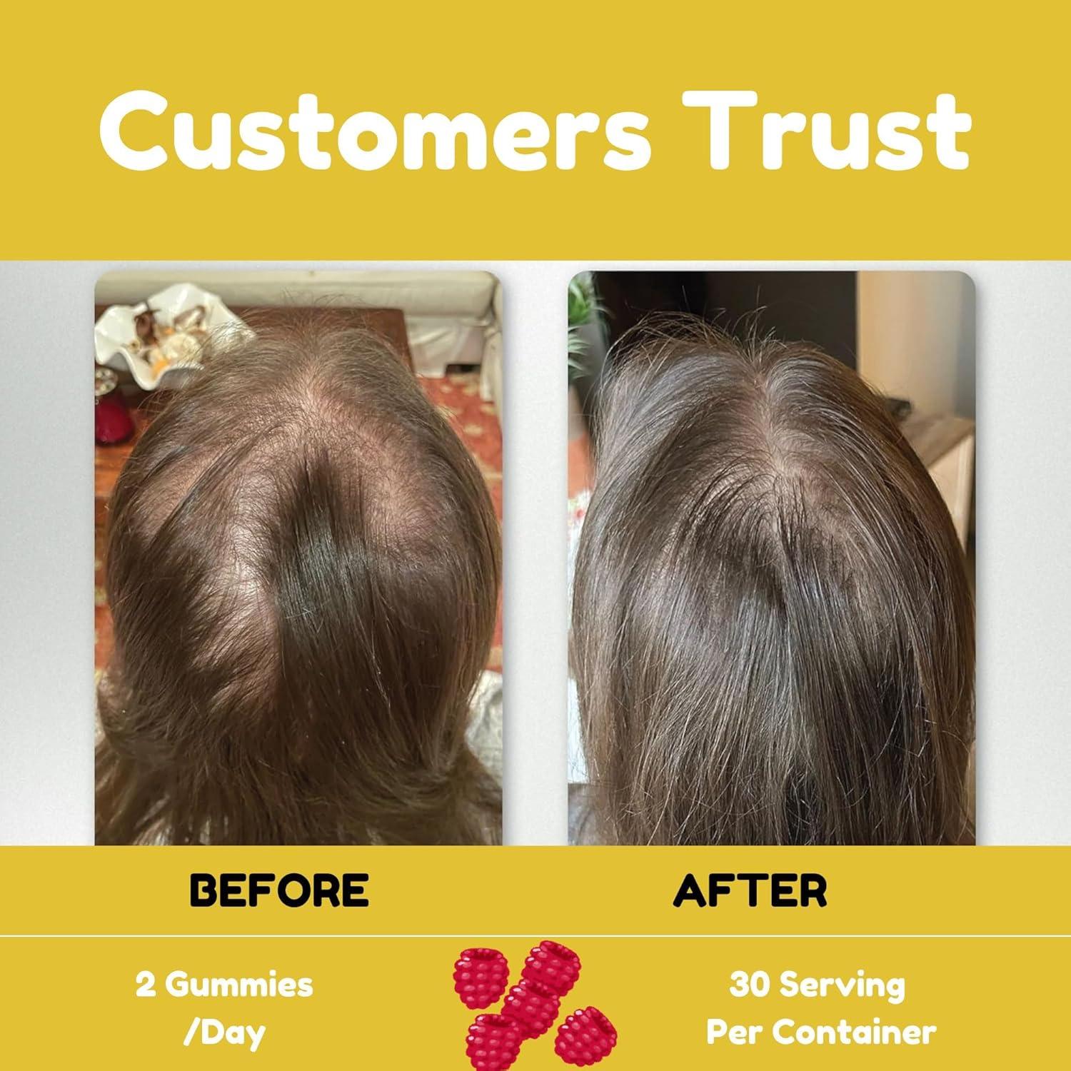 Gomitas Veganas Power Grain 5000 Mcg Biotina 219g - Cabello, Piel y Uñas